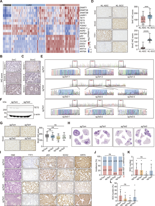 CRISPR-mediated Tet2 KO inhibits squamous transition in KL model. (A) Heatmap of gene expression of DNA methylation regulators and lineage-defined biomarkers in human normal lung, LUAD, and LUSC (from TCGA dataset). (B) Representative IHC staining of various levels of 5mC (relative scores: 1, 2, 3). Scale bar: 50 μm. (C) Representative IHC staining of various intensity of 5hmC (relative scores: 1, 2, 3). Scale bar: 50 μm. (D) Representative IHC staining of 5mC, 5hmC, TTF1, and p63 in KL-ADC and KL-SCC. Scale bar: 50 μm. Statistical analyses are shown on the right. 45 representative images for each group were counted. (E) KO efficiency detection of sgTet1/2/3 through Sanger sequence. The targeting site is marked by box. (F) KO efficiency detection of sgTet2 through western blot in tumors with Tet2 KO using lentivirus in KL mice. β-Actin served as the internal loading control. (G) Representative IHC staining of 5hmC in KL lung tumors with Tet1/2/3 individual KOs. Scale bar: 50 μm. Statistical analyses are shown on the right. 30 representative images for each group were counted. (H) Representative H&E staining of whole mouse lungs with Tet1/2/3 individual KOs. * indicates SCC. Scale bar: 1 mm. (I) Representative H&E and IHC staining for TTF1, p63, SOX2, and KRT5 in mouse lung tumors with Tet1/2/3 individual KOs. Scale bar: 50 μm. (J–L) Statistical analyses of the AST incidence (J), the number (K), and burden (L) of SCC in KL mice with Tet1/2/3 individual KOs (sgTom: n = 6; sgTet1: n = 6; sgTet2: n = 6; sgTet3: n = 5). Data in B–F represent one experiment of three independent repeats, and G–L represent one experiment of two independent repeats. **P < 0.01, ***P < 0.001, ****P < 0.0001 by two-tailed unpaired Student’s t test (D), one-way ANOVA test (G, K and L), Fisher’s exact test (J). ns: not significant. Data are represented as mean ± SD. Source data are available for this figure: SourceData FS1. Refer to the image caption for details.