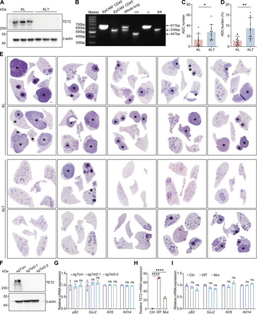 Tet2 KO inhibits lung AST in KL model. (A) Western blot analysis for TET2 in KL and KLT tumors. β-Actin served as the internal loading control. (B) KO efficiency detection of Tet2 in cancer cells (CD45− EpCAM+), tumor-associated immune cells (CD45+ EpCAM−), and whole lung isolated from KLT tumors. “+/+” means the lung tissue isolated from wild-type mice. “−/−” means the homozygous deletion of Tet2 gene alleles. “fl/fl” means the floxed Tet2 gene alleles with intact gene expression before Cre administration. (C and D) Statistical analyses of number (C) and burden (D) of ADC in KL (n = 10) and KLT (n = 10) mice after 10 wk of Adeno-Cre treatment. (E) Representative H&E staining of whole lungs from KL and KLT mice. * indicates SCC. Scale bar: 1 mm. (F) Detection of TET2 protein in the KL squamous organoids with CRISPR-mediated Tet2 KO by western blotting. β-Actin serves as an internal loading control. (G) Relative mRNA expression of p63, Sox2, Krt5, and Krt14 in the KL squamous organoids upon Tet2 KO by RT-qPCR. (H) Relative mRNA expression of TET2 in the KL squamous organoids after overexpressing wild-type (WT) and inactive mutant (Mut) TET2 by RT-qPCR. (I) Relative mRNA expression of p63, Sox2, Krt5, and Krt14 in the KL squamous organoids after overexpressing wild-type (WT) and inactive mutant (Mut) TET2 by RT-qPCR. Data in A, B, and F–I represent one experiment of three independent repeats, and C–E represent one experiment of two independent repeats. *P < 0.05, **P < 0.01 by two-tailed unpaired Student’s t test (C and D), ****P < 0.0001 by one-way ANOVA test (G–I). ns: not significant. Data are represented as mean ± SD. Source data are available for this figure: SourceData FS2.