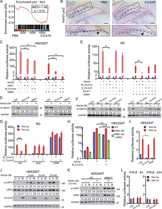 CV-A10 impairs Wnt/β-catenin signaling by KRM1. (A) GSEA comparing gene expression profiles from control and CV-A10 infection mouse digits with Wnt target genes. 9-day-old neonatal mice were mock-treated with PBS or infected with 104 TCID50 CV-A10 in a 10 μl volume (n = 5 for each group). Digits of the hind limbs from one mouse were amputated at the proximal level and collected for RNA extraction and RNA-seq (6 dpi). NES, normalized enrichment score. (B)Axin2-LacZ reporter mice at 9 days old were challenged with PBS (control) or CV-A10 and analyzed at 5 dpi. Wnt activity was evaluated using the Axin2-LacZ reporter activity. Blue, LacZ signal. Arrowheads (black) indicate differences in the distal matrix. The dashed box represents the enlarged areas. Dashed lines indicate the border between the nail matrix (basal nail layer) and the dermis (connective tissue). Scale bars, 100 μm. The results represent three independent experiments. (C and E) TopFlash-luciferase reporter assay. The indicated cells were transfected with TopFlash-luciferase reporters and seeded into a 24-well culture plate after treatment with Wnt3a CM, DKK1, mature CV-A10 (M_CV-A10), empty CV-A10 (E_CV-A10), and EV-A71 for 24 h and then harvested for luciferase determination. KRM1 overexpressed cells were generated by transfected with TopFlash-luciferase reporters and full-length KRM1 (right). (D and F) The expression of β-catenin in HEK293T (D) and RD (F) cells was measured by western blot assay. (G) Wnt/β-catenin signaling was activated by transfecting the Dvl2-EGFP plasmid or adding 1 μM CHIR. (H) CV-A10–induced Wnt/β-catenin signaling was inconspicuous in KRM1KD cells and reemerged by KRM1 re-expression in HEK293T cells. (I) The expression levels of the reporter were measured 4 h following treatment with either mature CV-A10 (20 ng/ml, ∼0.1 MOI) or an equivalent amount of viral RNA. Data from three independent experiments are shown as means with SD. Statistically significant differences were determined by two-tailed Student’s t test and are indicated in the figures as *, P < 0.05; **, P < 0.01; ***, P < 0.001; and ns, not significant. (J and K) HEK293T cells (J) or KRM1KDcells (K) were treated with PBS (control, C), 20 ng/ml empty (E) or mature (M) CV-A10 virus (20 ng/ml, ∼0.1 MOI) for 24 h and then stimulated with Wnt3a conditional medium for the indicated time. Phosphorylation of LRP6 at Ser1490 was detected by immunoblotting. (L) HEK293T cells were transfected with the pRL-TK Renilla luciferase plasmid and IFN-β-Luc promoter for 24 h and then infected with CV-A10 (0.1 MOI) for the indicated time. All the experiments were repeated at least three times. See also Figs. S1, S2, S3, and S4. Source data are available for this figure: SourceData F3. Refer to the image caption for details.