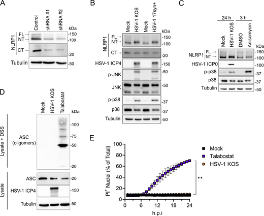 HSV-1 infection activates receptor proximal steps in the NLRP1 inflammasome pathway but does not form a functional inflammasome. (A) Immunoblots of lysates examining NLRP1 abundance in primary human keratinocytes transduced with control or shNLRP1-expressing lentiviruses. Images are representative of n = 3 biological replicates. (B) Immunoblots of lysates from mock-infected or WT HSV-1 strains KOS or 17syn+-infected primary human keratinocytes (MOI 10) at 24 h.p.i. Images are representative of n = 3 biological replicates. (C) Immunoblots of lysates from HSV-1 (MOI 10) or anisomycin (10 μM) -treated primary human keratinocytes harvested at indicated time points. Images are representative of n = 3 biological replicates. (D) Immunoblots of ASC oligomerization status in DSS-treated lysates from mock-infected, HSV-1 KOS–infected (MOI 10), or talabostat-treated (30 μM) primary human keratinocytes for 24 h. A portion of the lysates was not treated with DSS and run in parallel to examine total ASC abundance under the indicated experimental conditions. Images are representative of n = 3 biological replicates. (E) Quantification of PI+ primary human keratinocyte nuclei following infection with HSV-1 KOS (MOI 10) or treatment with talabostat (30 μM). PI+ nuclei were quantified hourly and plotted as a percentage of total nuclei detected at each time point imaged. Data are presented as the mean of three independent experiments ± SEM. The area under the curve was calculated for each condition and statistical significance was determined by Student’s t test (**P < 0.01). Source data are available for this figure: SourceData F1.