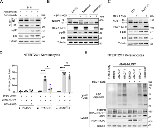 HSV-1 inhibits proteasome-dependent NT-NLRP1 degradation. (A) Immunoblots of lysates from primary human keratinocytes treated with anisomycin (1 μM) and/or bortezomib (10 μM) for 24 h. Images are representative of n = 3 biological replicates. (B) Immunoblots of lysates from primary human keratinocytes infected with HSV-1 KOS (MOI 10) for 4 h followed by treatment with talabostat (30 μM) or anisomycin (1 μM) for 24 h. Images are representative of n = 3 biological replicates. (C) Immunoblots of lysates from primary keratinocytes infected with HSV-1 KOS (MOI 10) for 4 h followed by transfection with poly(I:C) (1 μg/ml) for 24 h. Images are representative of n = 3 biological replicates. (D) NTERT2G1 keratinocytes expressing an empty vector or dTAG-NLRP1 were infected with HSV-1 KOS for 4 h followed by treatment with dTAG-13 or dTAGV-1. Membrane permeability was assessed at 8 h after treatment. Data are presented as the mean of three independent experiments ± SEM. Statistical significance was calculated by Student’s t test (*P < 0.05, ***P < 0.001, ****P < 0.0001). (E) Immunoblot of ASC oligomers and lysates from NTERT2G1 keratinocytes expressing dTAG-NLRP1 infected with HSV-1 for 4 h followed by treatment with DMSO, dTAG-13, or dTAGV-1 for 4 h. Images are representative of n = 3 biological replicates. Source data are available for this figure: SourceData F3. Refer to the image caption for details.