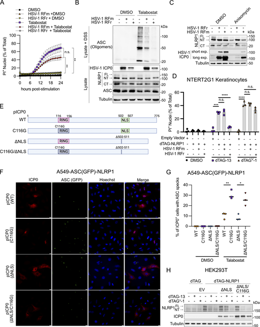 Cytoplasmic ICP0’s E3 ubiquitin ligase activity is required to inhibit the NLRP1 inflammasome. (A) Kinetics of membrane permeability in primary human keratinocytes infected with HSV-1 ICP0 RING finger mutant (RFm) and RING finger rescue (RFr) at a MOI of 10 for 4 h followed by treatment with talabostat (30 μM). Data are presented as the mean ± SEM of three independent experiments. Area under the curves were calculated for each treatment and statistical significance was calculated by Student’s t test (**P < 0.01). (B) Immunoblots of ASC oligomers in DSS-treated primary human keratinocytes infected with HSV-1 RFm or RFr at a MOI of 10 for 4 h followed by treatment with talabostat (30 μM). Images are representative of n = 3 biological replicates. (C) Immunoblots of lysates from primary human keratinocytes infected with HSV-1 RFm or RFr rescue virus at a MOI of 10 for 4 h followed by treatment with Anisomycin (1 μM) for 24 h. Images are representative of n = 3 biological replicates. (D) Quantification of membrane permeability from control or dTAG-NLRP1 NTERT2G1 keratinocytes infected with HSV-1 RFm or RFr (MOI 10) for 4 h followed by treatment with dTAG-13 or dTAGV-1 for 8 h. Data are presented as the mean ± SEM of three independent experiments. Statistical significance was calculated by Student’s t test (***P < 0.001, ****P < 0.0001). (E) Diagram of WT and mutant ICP0 constructs generated for this study and used in panels F–H. (F) Micrographs of A549-ASC(GFP)-NLRP1 cells transfected with indicated ICP0 constructs followed by TNF and talabostat (30 μM) treatment (scale bar = 10 μm). Images are representative of n = 3 biological replicates. (G) Quantification of ASC speck formation in micrographs from F. Data are presented as the mean ± SEM of three experiments. Statistical significance was calculated by Student’s t test (*P < 0.05, **P < 0.01). (H) Immunoblots from HEK293T cells transfected with dTAG-NLRP1 and/or pICP0ΔNLS and pICP0ΔNLS C116G followed by treatment with dTAG-13 or dTAGV-1 for 24 h. Images are representative of n = 3 biological replicates. Source data are available for this figure: SourceData F5. Refer to the image caption for details.