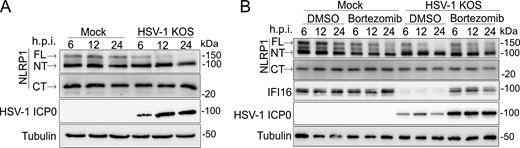 HSV-1 induces the proteasome-dependent loss of FL-NLRP1. (A) Immunoblots of lysates from mock-infected or HSV-1 KOS strain–infected primary human keratinocytes (MOI 10) at 6, 12, 24 h.p.i. Images are representative of n = 3 biological replicates. (B) Immunoblots of lysates from DMSO or bortezomib (10 μM) -treated primary human keratinocytes infected with HSV-1 strain KOS (MOI 10) and harvested at indicated time points. Images are representative of n = 3 biological replicates. Source data are available for this figure: SourceData FS1. Refer to the image caption for details.