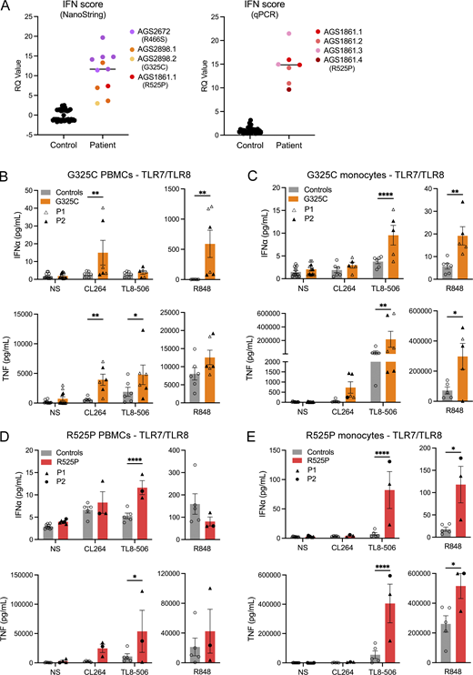TLR signaling ex vivo. (A) ISG expression was measured in controls and patients, using either a 27 (left) or 6 (right) ISG panel (measured on a NanoString platform or using RT-qPCR, respectively) to calculate an IFN score. Colors denote individuals. Values correlate to data presented in Table S1. (B–E) Ex vivo stimulation of blood cells. (B and D) IFNα and TNF production following stimulation of TLR7 (CL264 5 µg/ml), TLR8 (TL8-506 10 ng/ml), and TLR7/8 (R848 0.5 µg/ml), in bulk PBMCs. (C and E) IFNα and TNF production following stimulation of TLR7 (CL264 5 µg/ml), TLR8 (TL8-506 10 ng/ml), and TLR7/8 (R848 0.5 µg/ml) in sorted monocytes. Cells were extracted from healthy individuals (controls), one symptomatic patient (G325C-P2) and one asymptomatic individual (G325C-P1) heterozygous for the G325C substitution (B and C), and two clinically symptomatic patients (R525P-P1 and R525P-P2) heterozygous for the R525P substitution (D and E) in UNC93B1. Mean ± SEM of two to three experiments with individual patient data represented by symbols and pooled according to mutation. Two-way ANOVA with Sidak’s post-hoc test (NS, CL264, and TL8-506) or Mann–Whitney test (R848): ****P < 0.0001, **P < 0.01, *P < 0.05. Source data are available for this figure: SourceData F3. Refer to the image caption for details.