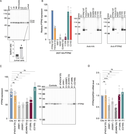 PTPN2 regulation and expression. (A) PTPN2 protein expression in human primary T (LT) and B lymphocytes (LB), NK cells, monocytes, Jurkat–T cell line, and EBV-derived control B cell lines (LCL). PTPN2 expression was analyzed using automated quantitative western blot. Relative expression of TC48 and TC45 isoforms in Jurkat–T cells is indicated in the lower panel (mean and SDs from five different experiments are represented). (B) PTPN2 expression in HEK293T cell transfected with different constructs. Protein expression was revealed with anti-HA (left panel) or anti-PTPN2 (right panel) antibodies and analyzed using automated quantitative western blot. Protein quantification was calculated on anti-HA expression normalized on total protein expression. Mean and SDs are shown and representative of at least three different experiments. (C) Endogenous PTPN2 protein expression in control and patient in vitro–activated T cells analyzed using automated quantitative western blot. Quantification was calculated on anti-PTPN2 expression normalized on total protein expression. Mean and SDs are shown and representative of three different experiments (ns, non-significant, *P < 0.05, **P < 0.01, one-way analysis of variance, Kruskal–Wallis test). (D) Real-time RT-QPCR assays of PTPN2 in control and patient in vitro activated T cells. Results represent the PTPN2 expression normalized to GAPDH expression, related to the expression of controls. Mean and SDs are shown and representative of at least three different experiments (ns, nonsignificant, *P < 0.05, **P < 0.01, ****P < 0.0001, one-way analysis of variance, Kruskal–Wallis test). All MW are in kDa. Source data are available for this figure: SourceData F2. Refer to the image caption for details.