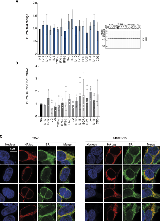 PTPN2 expression following PBMC stimulation and intracellular localization. (A) PTPN2 protein in PBMCs stimulated 6 h with indicated cytokines or ligands was quantified using automated quantitative western blot. Protein quantification was calculated on anti-PTPN2 expression normalized on total protein expression. Mean and SDs are shown and representative of three different experiments. All MW are in kDa. (B) PTPN2 mRNA was measured in control PBMCs stimulated 6 h with indicated cytokines or ligands. Mean and SDs are shown and representative of three different experiments. (C) Confocal microscopy analysis of PTPN2 subcellular localization. Constructs were overexpressed in HEK293T cells and detected with anti-HA antibody together with endoplasmic reticulum and nucleus staining. Source data are available for this figure: SourceData FS1. Refer to the image caption for details.