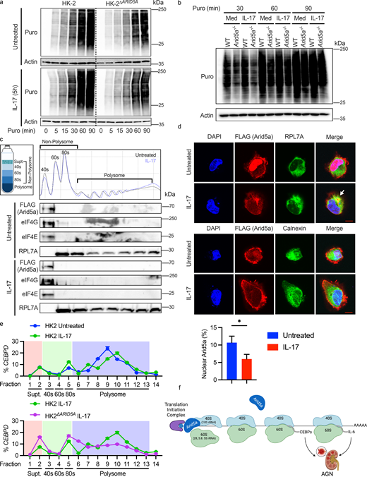 Arid5a facilitates protein synthesis in RTECs. (a) HK-2 cells were treated ± IL-17 for 5 h, labeled with puromycin, and immunoblotted with anti-puromycin or β-actin Abs, representative of three independent experiments. (b) Primary mouse RTECs were treated ± IL-17 for 5 h and labeled with puromycin. Lysates were immunoblotted with anti-puromycin or β-actin Abs, representative of three independent experiments. Med, media alone. (c) Cells were transfected with Flag-Arid5a and treated ± IL-17 for 3 h. Cytoplasmic lysates were separated by sucrose gradient fractionation. Y-axis shows A260 absorbance. Expression of Flag (Arid5a), eIF4G, eIF4E, and RPL7A was assessed in three pooled fractions per sample. Data representative of three independent experiments. (d) HK-2 cells were treated ± IL-17 for 3 h, stained with DAPI or Abs against Flag, RPL7A, or calnexin, and imaged by confocal microscopy. Size bar = 10 µm. Representative images are shown. Quantitation of nuclear Arid5a is shown below. Each value represents the percentage of colocalized volume from an individual cell (n = 218–225). Arrow denotes region of co-association of Arid5a with RPL7A. Analyzed by Student’s t test. (e) HK-2 cells were treated ± IL-17 for 1 h, and CEBPD in two pooled fractions per sample was assessed by qPCR, presented as a percent of total CEBPD from all fractions. Shading: pink denotes supernatant (Supt), green denotes 40S, 60S, and 80S fractions, and blue denotes polysomes. (f) Proposed mechanism of Arid5a function in AGN: Arid5a binds to 18S rRNA (40S ribosome subunit). Arid5a also binds to the 5S rRNA (60S), though interactions are likely weak or transient. Arid5a enhances translational efficiency of CEBPD and IL6 among other RNAs, cumulatively promoting pathology in AGN. *P < 0.05. Source data are available for this figure: SourceData F6.