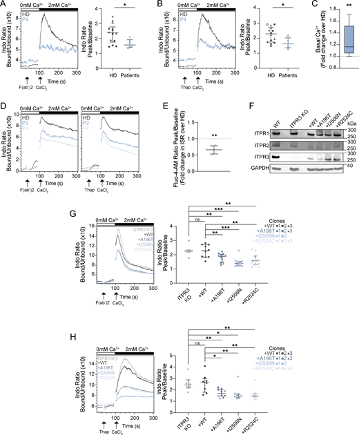 Variant ITPR3 proteins impair Ca2+flux in Tcells. (A–C) In primary T cells: Ca2+ flux after stimulation with (A) anti-CD3 plus F(ab′)2 and (B) thapsigargin (Thap) in Ca2+-free media and after addition of CaCl2. The left panels show representative examples of Ca2+ flux in primary T cells from P4 (blue) versus one HD (grey). The right panels show the ratio between the peak (100–150 s) versus baseline (0–30 s) in P2 (pre-HCT), P4 (untransplanted), and P5 (pre-HCT) versus 10 HDs. Independent replicates are included for two patients (n = 2 for P2 and P4) and three HDs. The lines show the median and the interquartile range. Triangles and circles distinguish between frozen and fresh samples, respectively (the HD indicated with an open triangle is the mother of P2, who carries the R1850Q polymorphism). *P < 0.05, Mann–Whitney U test. (C) Baseline cytosolic Ca2+ levels in primary patient T cells, expressed as fold change over HD. Data represent 12 HD and 12 patient samples (P2, P4, and P5), pooled across four independent experiments; **P <0.01, paired T test. (D–E) In CTLs: Ca2+ flux after stimulation with (D) anti-CD3/F(ab′)2 (left panel) and thapsigargin (right panel) in Ca2+-free media and after addition of CaCl2 in CTLs from P2 and P4 (blue) versus one HD (grey). This is representative of four independent experiments. (E) Ca2+ flux after stimulation with ionomycin in Ca2+-free media in CTLs from P2 and P4 (light blue) versus one HD; representative of two independent experiments. **P < 0.01, Welch’s T test. (F–H) In Jurkat T cell lines: (F) western blots for ITPR1, ITPR2, ITPR3, and GAPDH from protein extracts from WT Jurkat T cells, ITPR3 KO Jurkat T cells, and stably transduced ITPR3 KO Jurkat T cells expressing WT ITPR3 or the A196T, I2506N, and R2524C proteins; representative of two independent experiments. (G–H) The left panels show representative Ca2+ flux after stimulation with (G) anti-CD3 and F(ab’)2 or (H) thapsigargin in one ITPR3 KO Jurkat T cell clone (light grey) and in stably transduced ITPR3 KO Jurkat T cells (derived from the same ITPR3 KO clone) expressing WT ITPR3 (dark grey) or the A196T, I2506N, and R2524C protein variants (shades of blue). The right panel shows the ratio between the peak versus baseline in the ITPR3 KO clone and in transduced KO cells expressing WT (three clones) or variant ITPR3 proteins (three clones for A196T, two clones for I2506N, and three clones for R2524C) in five independent experiments. ns: non-significant, *P < 0.05, **P = 0.01, and ***P < 0.01, Mann–Whitney U test. Source data are available for this figure: SourceData F4.
