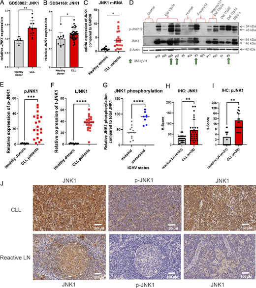 JNK1 is overexpressed and hyperphosphorylated in primary human CLL. (A and B) Gene sets, GDS3902 (n = 16) and GDS4168 (n = 36) published in the GEO database comparing B cells from healthy donors with CLLs were analyzed regarding JNK1 mRNA expression (unpaired t test, *P < 0.05; **P < 0.01). (C) TaqMan PCR was performed for JNK1 and GAPDH from RNA extracted from CLL patient samples (n = 20, patients #1–20) and CD19+ lymphocytes from healthy donors (n = 7). JNK1 transcript levels were normalized to GAPDH and healthy donor control was set to 1 (patient characteristics in Table S1; unpaired t test, *P < 0.05). (D) Protein expression of p-JNK1 and total JNK1 in CLL patient samples (n = 12), and CD19+ lymphocytes from healthy donors (n = 2). β-Actin was used as a loading control and MEC1 cells as a positive control. Patients with unmutated IGHV are marked with green arrows. (E and F) Relative expression of p-JNK1 and total JNK1 were compared with β-actin in CLL patient samples (n = 21) and CD19+ lymphocytes from healthy donors (n = 7 controls). Western blots: Fig. 1 D and data not shown (unpaired t test, ***P < 0.001, ****P < 0.0001). (G) Relative phospho-JNK1 compared with total JNK1 in IGHV mutated (n = 13) and unmutated (n = 8) CLL patient samples (unpaired t test, ****P < 0.0001). (H) JNK1 level (H-score) in reactive lymph nodes (n = 21) and lymph nodes from CLL patients (n = 28) (unpaired t test, **P < 0.01). (I) Phospho-JNK1 levels in the same samples (unpaired t test, **P < 0.01). (J) Representative examples of IHC images from lymph nodes of CLL patients (upper row) or reactive lymph nodes (lower row) stained for total JNK1 (first and last column) or phospho-JNK1 (medium column). Source data are available for this figure: SourceData F1.