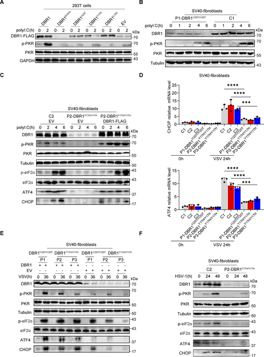 DBR1 mutants from the patients fail to potentiate the PKR-mediated stress response. (A) WT DBR1 or DBR1 variants from patients with brainstem encephalitis were overexpressed in HEK293T cells and then stimulated with polyI:C transfection (1 µg/ml). The cells were lysed and subjected to WB for detection of the indicated proteins. GAPDH was used as a loading control. Data shown are representative of three independent experiments. (B and C) SV40-transformed fibroblasts (SV40-fibroblasts) from control and two patients, P1-DBR1I120T/I120T (B) and P2-DBR1Y17H/Y17H without and with WT DBR1 rescue (C) were transfected with 1 µg/ml polyI:C and subjected to WB with the indicated antibodies. Tubulin was used as a loading control. Data shown are representative of three independent experiments. (D) SV40-fibroblasts from control or DBR1-deficient patients were infected with VSV, and RT-qPCR was performed to assess the expression of the indicated ISR genes. Data are representative of three independent experiments. Graphs depict the mean with SD, and points represent biological replicates. Statistical analysis was performed with one-way ANOVA with Dunnett’s multiple comparisons test. ***, P < 0.001; ****, P < 0.0001. (E) SV40-fibroblasts from three patients, P1-DBR1I120T/I120T, P2-DBR1Y17H/Y17H, and P3-DBR1Y17H/Y17H without or with WT DBR1 rescue were infected with VSV at an MOI of 0.1, followed by WB for indicated antibodies. Tubulin was used as a loading control. Data shown are representative of three independent experiments. (F) SV40-fibroblasts from a healthy control and a DBR1-deficient patient were infected with HSV-1 at an MOI of 0.5, followed by WB for indicated antibodies. Tubulin was used as a loading control. Data shown are representative of three independent experiments. Source data are available for this figure: SourceData F2.