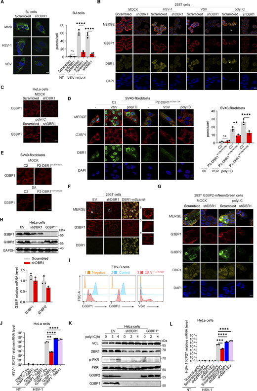 G3BP SG assembly and G3BP protein levels remain low in DBR1-deficient cells. (A) BJ cells transduced with the scrambled control shRNA or with shDBR1 were infected with the indicated viruses, and SG formation was then followed by G3BP1 staining, microscopy imaging, and the SG puncta quantification. Scale bar, 20 µm. Data shown are representative of three independent experiments. Graphs depict the mean with SD and points represent biological replicates. Statistical analysis was performed with one-way ANOVA with Dunnett’s multiple comparisons test. ****, P < 0.0001. (B) HEK293T cells transduced with the scrambled shRNA or with shDBR1 were stimulated with polyI:C (1 µg/ml) or infected with VSV (MOI: 0.01) or HSV-1 (MOI: 0.05) and G3BP1 was then detected by fluorescence. Scale bar, 20 µm. Data shown are representative of six independent experiments. (C) HeLa cells transduced with the scrambled control shRNA or with shDBR1 were stimulated with polyI:C (1 µg/ml) and G3BP1 was then detected by fluorescence microscopy. Scale bar, 20 µm. Data shown are representative of three independent experiments. (D and E) Control cells and cells from a DBR1-deficient patient were infected with VSV (MOI = 0.01) for 24 h, stimulated with polyI:C (1 µg/ml) for 4 h (D), or treated with 500 µM sodium arsenite (SA) for 1 h (E). Immunofluorescence staining was then performed for the indicated markers and SGs were quantified. Scale bar, 20 µm. Data shown are representative of three independent experiments. Graphs depict the mean with SD and points represent biological replicates. Statistical analysis was performed with one-way ANOVA with Dunnett’s multiple comparisons test. NS, not significant, **, P < 0.01; ****, P < 0.0001. (F) HEK293T cells transduced with shDBR1 or DBR1-mscarlet were subjected to immunofluorescence staining for the indicated markers. Scale bar, 20 µm. Data shown are representative of three independent experiments. (G) HEK293T cells transduced with the scrambled control shRNA, and shDBR1 cells expressing G3BP2-mNeonGreen were transfected with polyI:C (1 µg/ml) for 4 h, and the markers indicated were then detected by fluorescence microscopy. Scale bar, 20 µm. Data shown are representative of six independent experiments. (H) RT-qPCR and WB detection of G3BP expression in indicated HeLa cells. GAPDH was used as a loading control. Data shown are representative of three independent experiments. Graph points represent biological replicates. (I) FACS analysis of the expression of G3BP (uninfected) and viral GFP after VSV-GFP (MOI: 0.01) infection for 24 h in EBV-B cells from a control or a DBR1-deficient patient. Data shown are representative of three independent experiments. (J and K) G3BP1+/+ and G3BP1−/− HeLa cells transduced with EV or DBR1 were infected with VSV-GFP (MOI: 0.01); viral gene expression was then quantified by RT-qPCR (J). Data shown are representative of three independent experiments. Graphs depict the mean with SD and points represent biological replicates. Statistical analysis was performed with one-way ANOVA with Dunnett’s multiple comparisons test. **, P < 0.01; ****, P < 0.0001. Proteins were detected by WB detection with indicated antibodies (K). Vinculin (VCL) was used as a loading control. Data shown are representative of three independent experiments. (L) Scrambled shRNA and shDBR1 HeLa cells transduced with EV or G3BP1 were infected with HSV-1. Viral gene expression was then quantified by RT-qPCR. Data shown are representative of three independent experiments. Graphs depict mean with SD, and points represent biological replicates. Statistical analysis was performed with one-way ANOVA with Dunnett’s multiple comparisons test. NS, not significant, ***, P < 0.001; ****, P < 0.0001. Source data are available for this figure: SourceData F5.