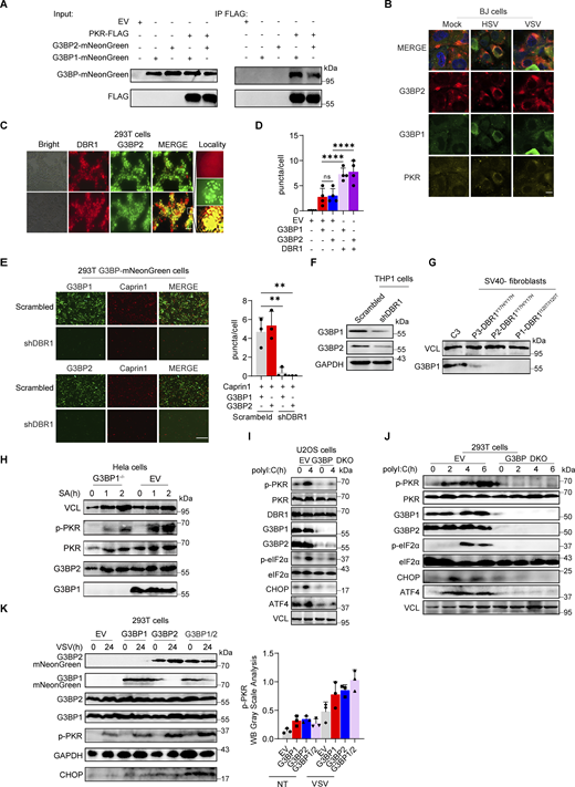 DBR1 licenses G3BP proteins to form SGs. (A) WB with indicated antibodies after immunoprecipitation with an anti-FLAG antibody on lysates of HEK239T cells in an overexpression system. Data shown are representative of three independent experiments. (B) BJ cells were infected with VSV at an MOI of 0.1, or HSV-1 at an MOI of 0.5 for 12 h; immunofluorescence detection was then performed for PKR, G3BP2, and G3BP1-mNeonGreen. Scale bars, 20 µm. Data shown are representative of three independent experiments. (C and D) HEK293T G3BP2-mNeonGreen/DBR1-mScarlet cells were imaged (C) and the intracellular G3BP2- mNeonGreen puncta were quantified (D). Scale bars, 50 µm. Data shown are representative of three independent experiments. Data are representative of three independent experiments. Graphs depict the mean with SD and points represent biological replicates. Statistical analysis was performed with one-way ANOVA with Dunnett’s multiple comparisons test. NS, not significant, ****, P < 0.0001. (E) Fluorescence images of HEK293T G3BP-mNeonGreen and HEK293T shDBR1/G3BP-mNeonGreen cells. Scale bars, 50 µm. Data shown are representative of three independent experiments. Data representative of three independent experiments. Graphs depict mean with SD, and points represent biological replicates. Statistical analysis was performed with one-way ANOVA with Dunnett’s multiple comparisons test. **, P < 0.01. (F and G) THP-1 cells (D) and cells from patients (E) and controls were analyzed by WB with the indicated antibodies. VCL was used as a loading control. Data shown are representative of three independent experiments. (H) G3BP1−/− HeLa cells and control cells were treated with 500 µM SA, and WB was then performed with the indicated antibodies. VCL was used as a loading control. Data shown are representative of three independent experiments. (I) G3BP DKO U2OS cells and control cells were stimulated with polyI:C (2 µg/ml) for 4 h, and WB was then performed with the indicated antibodies. VCL was used as a loading control. Data shown are representative of three independent experiments. (J) G3BP DKO HEK293T cells and control cells were stimulated with polyI:C (1 µg/ml) for various time points, and WB was then performed with the indicated antibodies. VCL was used as a loading control. Data shown are representative of three independent experiments. (K) HEK293T cells with overexpression of the indicated proteins were infected with VSV at an MOI of 0.1, and WB was then performed with the indicated antibodies, followed by the p-PKR/PKR WB gray scale analysis of three independent experiments. GAPDH was used as a loading control. Graphs depict points represent biological replicates. Data shown are representative of three independent experiments. Source data are available for this figure: SourceData FS3.