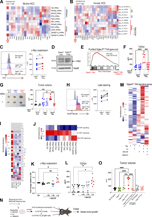GM-CSF and linoleic acid activate c-Myc regulon and drive SiglecFhiTAN development. (A and B) Relative differential transcription factor activity within each neutrophil subset in NRAS/AKT HCC mice (A) and HCC patients (B). (C) Representative histograms and c-Myc levels within SiglecF– and SiglecFhi TANs. (D) c-Myc expression assessed by western blot. Proteins were extracted from TANs subsets isolated from five mice. (E–G) SiglecF− and SiglecFhi TANs were treated with or without 10058-F4 (100 μM). GSEA analysis of genes defining SiglecFhi TANs (E). Spontaneous TGFβ production (F). RIL175 cells were s.c. injected with different TAN subsets. Tumor volume at day 8. Scale bar represents 1 cm (G). (H) Representative histograms and neutral lipid levels within SiglecF– and SiglecFhi TANs. (I) GC-MS analysis of HCC tumors and naïve liver. (J) Relative scores of M-CSF, G-CSF, and GM-CSF signaling within neutrophil subsets from NRAS/AKT HCC mice. (K and L) BM neutrophils from NRAS/AKT HCC mice were cultured overnight with or without the addition of GM-CSF (20 ng/ml) and the indicated fatty acids (50 μM). c-Myc expression (K) and TGFβ1 production (L). (M–O) BM neutrophils from NRAS/AKT HCC mice were cultured overnight with or without the addition of GM-CSF, linoleic acid, or 10058-F4. Heatmap of genes defining SiglecFhi TANs (M). Schematic diagram of adoptive transfer strategy (N). Tumor volume (O). Each symbol represents one mouse (C, H, K, L, and O) or TANs isolated from two to three mice (F and G). Data are mean ± SEM (F, G, K, L, and O) and are pooled from two (C, F–H, K, and L) or four (O) independent experiments. *P < 0.05, **P < 0.01, ***P < 0.001, ****P < 0.0001 by Wilcoxon matched-pairs signed rank test (C and H) and one-way ANOVA (F, G, K, L, and O). MFI, median fluorescence intensity; CM, complete media. Source data are available for this figure: SourceData F7. Refer to the image caption for details.