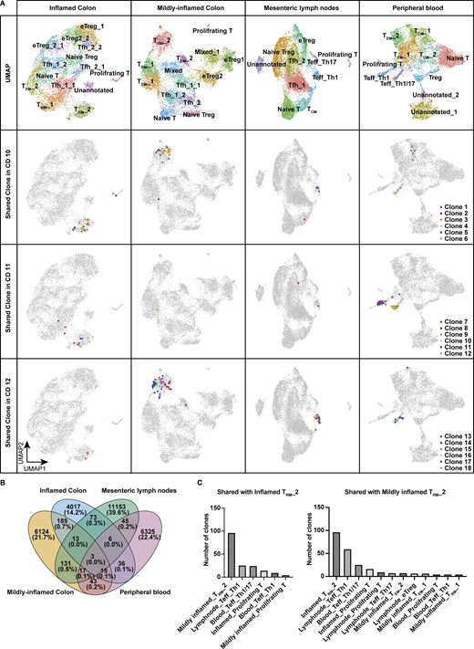 Single-cell TCR repertoire analysis across blood, lymph node, and colon. (A) Upper panels: UMAP plots showing the annotation of CD4+ T cells isolated from inflamed colon, mildly inflamed colon, MLN, and peripheral blood of CD patients (n = 3, CD Patient 10–12 in Table S1). Lower three panels: Top six CD4⁺ T cell clones within TRM_2 shared across different tissues in each patient. (B) Venn diagram showing the total number of shared clones across tissues. (C) Number of clones shared with TRM_2 of inflamed and mildly inflamed colon in each CD4+ T cell cluster. Clusters sharing more than five clones are displayed.