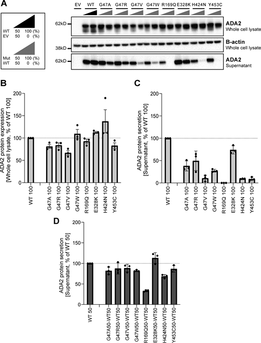 ADA2 protein expression and secretion in the homogenous and heterozygous state on a denaturing gel. (A) Immunoblot of whole-cell lysate and supernatants of HEK293T cells transfected with different ADA2 variants in the homozygous state or together with WT ADA2 (heterozygous state). Cells and supernatant were collected 48 h after transfection. The image shown represents three independent experiments. Loading control: B-actin. (B) Quantification of ADA2 protein expression in the whole-cell lysate of HEK293T cells transfected with WT ADA2 or ADA2 variants in homozygous conditions. Bar graphs represent the percentage of ADA2 protein expression relative to WT100% ADA2. (C) Quantification of ADA2 secretion in the supernatant of HEK293T cells transfected with WT ADA2 or ADA2 variants in homozygous conditions. Bar graphs represent the percentage of ADA2 protein expression relative to WT100% ADA2. (D) Quantification of ADA2 secretion in supernatant cotransfected HEK293T cells of ADA2 variants together with WT in heterozygous conditions. Bar graphs represent the percentage of ADA2 secretion relative to WT50% ADA2. (A–D) Each bar represents the mean ± SD from three independent experiments. EV, empty vector. Source data are available for this figure: SourceData F3. Refer to the image caption for details.
