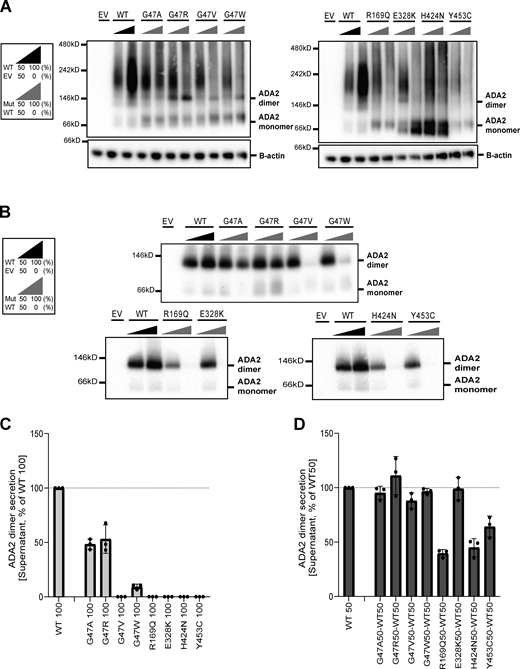 Expression and secretion of ADA2 dimers in the homozygous or heterozygous state on a nondenaturing gel. (A) ADA2 dimer expression of HEK293T cells transfected with WT and/or ADA2 variants. Cells were collected 48 h after transfection. A protein smear indicative of ADA2-containing aggregates is observed across the blot lane. (B) ADA2 dimer secretion of HEK293T cells transfected with WT and/or ADA2 variants. The supernatant was collected 48 h after transfection. (C) Quantification of ADA2 secretion in the supernatant of HEK293T cells transfected with WT ADA2 or ADA2 variants in homozygous conditions. Bar graphs represent the percentage of ADA2 protein secretion relative to WT100% ADA2. (D) Quantification of ADA2 secretion of cotransfected HEK293T cells of ADA2 variants together with WT ADA2 in heterozygous conditions. Bar graphs represent the percentage of ADA2 secretion relative to WT50% ADA2 experiments. (A–D) Image shown represents three independent experiments. EV, empty vector. Source data are available for this figure: SourceData F4. Refer to the image caption for details.