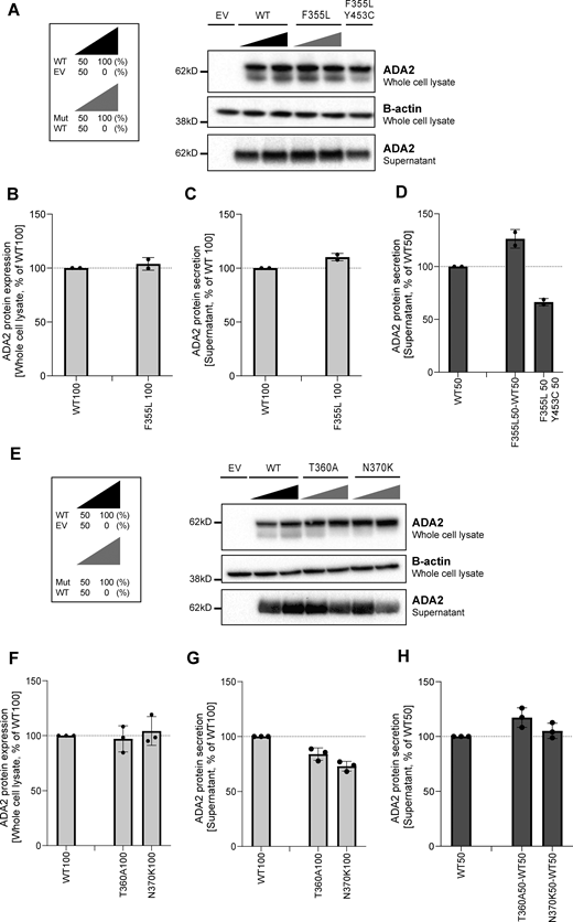 ADA2 protein expression and secretion in the homogenous and heterozygous state of variants F355L, T360A, and N370K on a denaturing gel. (A and E) Immunoblot of the whole-cell lysate and supernatants of HEK293T cells transfected with ADA2 variants F355L in the homozygous state, together with the WT ADA2 or with ADA2 variant Y453C in the carrier state, or HEK293T cells transfected with ADA2 variants T360A and N370K in the homozygous state or together with WT ADA2, respectively. Cells and supernatant were collected 48 h after transfection. The image shown represents two and three independent experiments, respectively. Loading control: B-actin. (B and F) Quantification of ADA2 protein expression in the whole-cell lysate of HEK293T cells transfected with WT ADA2 or ADA2 variants F355L, T360A, and N370K in homozygous conditions. Bar graphs represent the percentage of ADA2 protein expression relative to WT100% ADA2. (C and G) Quantification of ADA2 secretion in the supernatant of HEK293T cells transfected with WT ADA2 or ADA2 variants F355L, T360A, and N370K in homozygous conditions. Bar graphs represent the percentage of ADA2 protein expression relative to WT100% ADA2. (D and H) Quantification of ADA2 secretion of cotransfected HEK293T cells of ADA2 variants F355L, T360A, and N370K together with WT in heterozygous conditions. Bar graphs represent the percentage of ADA2 secretion relative to WT50% ADA2. (B–G) Each bar represents the mean ± SD from two to three independent experiments, respectively. EV, empty vector. Source data are available for this figure: SourceData FS1.