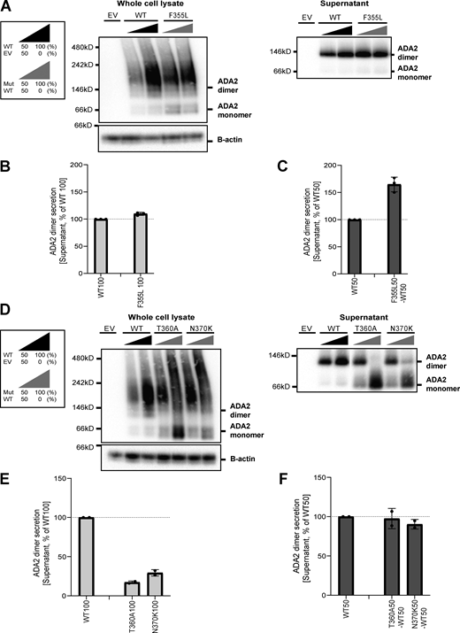ADA2 dimers in the homozygous or heterozygous state of variants F355L, T360A, and N370K on a nondenaturing gel. (A and D) ADA2 monomer and dimer expression/secretion of HEK293T cells transfected with WT and/or ADA2 variants F355L, T360A, and N370K. Cells and supernatant were collected 48 h after transfection. The image shown represents three and two independent experiments, respectively. (B and E) Quantification of ADA2 secretion in the supernatant of HEK293T cells transfected with WT ADA2 or ADA2 variants F355L, T360A, and N370K in homozygous conditions. Bar graphs represent the percentage of ADA2 protein secretion relative to WT100% ADA2. (C and F) Quantification of ADA2 secretion of cotransfected HEK293T cells of ADA2 variants F355L, T360A, and N370K together with WT ADA2 in heterozygous conditions. Bar graphs represent the percentage of ADA2 secretion relative to WT50% ADA2. (B–F) Each bar represents the mean ± SD from three to two independent experiments, respectively. EV, empty vector. Source data are available for this figure: SourceData FS2.