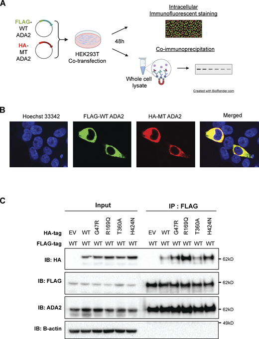 Co-immunoprecipitation of FLAG-WT ADA2 and HA-ADA2 G47R, R169Q, T360A, or H424N supports interaction between WT ADA2 and mutant ADA2. (A) Illustration depicting experimental workflow used for B and C. (B) Representative confocal microscopy image of cotransfected HEK293T cells stained for FLAG-tagged WT ADA2, HA-tagged MT ADA2, and nucleus illustrating successful cotransfection of differentially tagged plasmids. Images were acquired on Andor Dragonfly Confocal Spinning Disk at 63× magnification. (C) Whole-cell lysates of HEK293T cells transiently cotransfected with FLAG-WT ADA2 and HA-ADA2 G47R, R169Q, T360A, or H4242 were co-immunoprecipitated with an anti-FLAG antibody. Western blot analysis of the whole-cell lysate and eluate of immunoprecipitation with anti-HA, anti-FLAG, anti-ADA2, and anti-B-actin. The image shown represents two independent experiments. EV, empty vector; IB, immunoblot. Source data are available for this figure: SourceData FS3. Refer to the image caption for details.