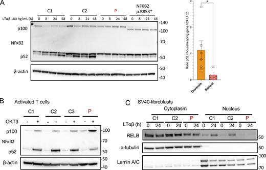 Non-canonical NF-κB signaling in patient cells. (A) Western blot of NFκB2 p100/p52 on cell lysates from SV40-fibroblasts after activation of the non-canonical pathway with LTαβ for 8, 24, or 48 h, as indicated. β-Actin was used as a loading control. Representative of at least three experiments. *: P-value <0.05 after Mann-Whitney Wilcoxon test. (B) Western blot of NFκB2 p100/p52 on cell lysates from activated T cells starved 24 h before stimulation with OKT3 for 48 h. β-Actin was used as a loading control. Representative of two experiments. (C) Western blot of cytoplasmic and nuclear protein extracts from SV40-fibroblasts activated with LTαβ for 24 h assessing the translocation of RELB in the nucleus. α-Tubulin was used the loading control of cytoplasmic extracts while Lamin A/C was used for nuclear extracts. Representative of three experiments. Source data are available for this figure: SourceData F5.