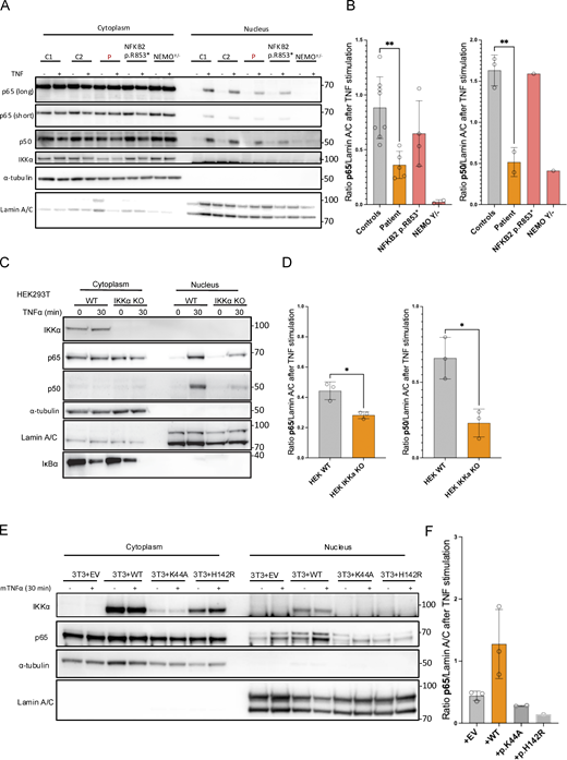 Defective translocation of p65 and p50 in SV40-fibroblasts and in IKKα-deficient cellular models. (A) Western blot of cytoplasmic and nuclear protein extracts from SV40-fibroblasts activated with TNFα for 30 min assessing the translocation of p65/RELA and p50 in the nucleus. α-Tubulin was used as a loading control of cytoplasmic extract while Lamin A/C was used for nuclear extracts. (B) Quantification of nuclear translocation for p65/RELA and p50. Statistical analysis was performed using an unpaired t test (**P < 0.01). Representative of at least three independent experiments. (C) Western blot of cytoplasmic and nuclear extracts from HEK293T cells (IKKα ΚΟ or not as indicated) after 30 min of TNFα (10 ng/ml) stimulation. RELA/p65 and p50 were revealed using a specific antibody to assess for translocation in the nucleus. α-Tubulin was used the loading control of cytoplasmic extract while Lamin A/C was used for nuclear extracts. IκΒα was probed as a control of stimulation. (D) Barplots show the quantification of translocation normalized to the quantity of Lamin A/C for RELA/p65 and p50 after stimulation. An unpaired t test was used to perform statistical analysis (*P < 0.05). (E) Western blot of cytoplasmic and nuclear extracts from 3T3-NIH IKKα knocked-out transduced back with a lentivirus coding for the human IKKα (or empty) with or without indicated mutations (p.K44A, kinase dead, p.H142R, patient variant). Cells were subjected to mouse TNFα stimulation (30 min, 10 ng/ml) before protein extraction. RELA/p65 was assessed as well as α-tubulin (used as a loading control of cytoplasmic extracts) and Lamin A/C (used as a loading control for nuclear extracts). (F) Barplots show the quantification of p65 translocation after stimulation for each transduced cell line. All figures are representative of at least two independent experiments. Source data are available for this figure: SourceData F8. Refer to the image caption for details.