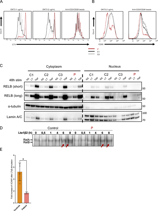 Functional impact of the variant on non-canonical and canonical NF-κB pathways. (A) Dilution histogram of Cell Trace Violet dye (CTV) after stimulation of activated T cells with OKT3 at 1 or 2 µg/ml for 4 days or anti-CD3/CD28 beads for 4 days. Representative of two independent experiments. (B) Histogram of CD69 activation marker upregulation on activated T cells after 4 days of stimulation with either OKT3 or anti-CD3/CD28 beads. Patient is in red, and controls are in gray. Representative of two independent experiments. (C) Western blot of cytoplasmic and nuclear extracts from SV40-fibroblasts after 48 h of LTαβ (LT) or TNFα (TNF) stimulation. RELB was revealed using a specific antibody to assess RELB production and nuclear translocation. α-Tubulin was used the loading control of cytoplasmic extract while Lamin A/C was used for nuclear extracts. The patient is indicated in red, and the controls are C1, C2, and C3. Representative of two independent experiments. (D) Electromobility shift assay on nuclear extracts from healthy control and patient SV40-fibroblasts after different time points of LTα1β2 stimulation showing the absence of RELB binding (red arrows) in patient as compared to controls (lower thin band) and the normal binding of RELA (upper band). Representative of three independent experiments. (E) Relative VCAM1 mRNA expression after 24 h of LTαβ relative to non-stimulated condition. These experiments have been performed on healthy controls and patient SV40-fibroblasts. *: P-value <0.05 after Mann-Whitney-Wilcoxon test. All figures are representative of at least two independent experiments. Source data are available for this figure: SourceData FS3. Refer to the image caption for details.
