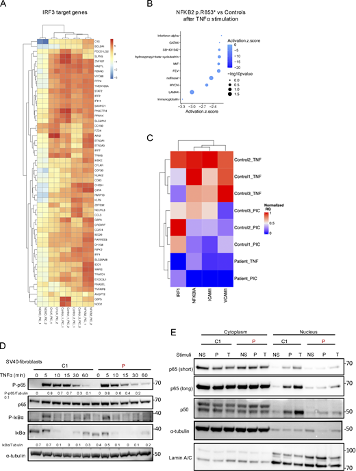 Bulk RNA sequencing of SV40-fibroblasts and RT-qPCR and western blot of the canonical NF-κB pathway. (A) Heatmap showing the normalized and scaled expression (vst) of IRF3 target genes significantly upregulated in controls after stimulation with poly I:C 10 µg/ml for 6 h. Each column represents a patient or a control. RNA sequencing has been performed in biological duplicates for each control or patient (as indicated by _1 or _2 at the end of each column name). (B) Z-score of the different “molecules” predicted to be inhibited (top 10 based on the z-score) based on IPA (Qiagen Inc.) after poly TNFα stimulation for the NFKB2 p.R853* cells. A negative score indicates that the molecule is predicted to be inhibited based on the DEGs that have been processed. (C) Heatmap showing the relative quantity normalized to GAPDH of each genes (scaled between 0 and 1, in column), for each control or the patient’s cells (in row) after stimulation with TNFα 10 ng/ml for 6 h or poly I:C 1 µg/ml for 6 h (as indicated by TNF or PIC respectively), as assessed by RT-qPCR. (D) Western blot assessing the quantity of phospho-p65 (S536), p65, phospho-IκBα (S32), and IκBα on cell lysates from SV40-fibroblasts stimulated with TNFα at indicated time points. Tubulin was used as a loading control. (E) Western blot of cytoplasmic and nuclear extracts from SV40-fibroblasts after 2 h of TNFα (T) (10 ng/ml) or poly I:C (P) (1 µg/ml) stimulation. RELA/p65 and p50 were revealed using a specific antibody to assess for translocation in the nucleus. α-tubulin was used as a loading control of cytoplasmic extract while Lamin A/C was used for nuclear extracts. Source data are available for this figure: SourceData FS5. Refer to the image caption for details.