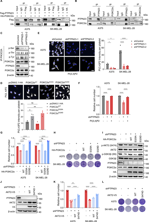 PTPN23 is required for PI3KC2α-mediated production of PI(3,4)P2 and AKT activation. (A) Interaction between exogenous HA-PI3KC2α and Flag-PTPN23 was detected by immunoprecipitation in A375 and SK-MEL-28 cells. (B) Endogenous PI3KC2α and PTPN23 interaction was detected by immunoprecipitation in A375 and SK-MEL-28 cells. (C) Immunoblot showing the phosphorylation of serine, threonine, and tyrosine residues of PI3KC2α after PTPN23 depletion in A375 cells. (D) Immunofluorescence showing the level of PI(3,4)P2 in A375 cells with pcDNA3.1-HA, PI3KC2αWT, PI3KC2αS329A, and PI3KC2αS329D overexpression. Quantification of PI(3,4)P2 signal intensity was obtained from three independent images (per group). Scale bar, 20 μm. One-way ANOVA, Dunnett’s test. (E) Immunofluorescence showing the level of PI(3,4)P2 after PTPN23 depletion in A375 and SK-MEL-28. Quantification of PI(3,4)P2 signal intensity was obtained from three independent images (per group). Scale bar, 20 μm. Two-way ANOVA, Dunnett’s test. (F) Relative cell number of A375 cells after PTPN23 depletion with or without exogenous soluble PI(3,4)P2 treatment, measured by the CCK8 assay after 72 h (n = 3). One-way ANOVA, Bonferroni’s test. (G) Relative cell number of PTPN23-depleted A375 cells overexpressing PI3KC2α WT, S329A, or S329D, measured by the CCK8 assay after 72 h (n = 3). One-way ANOVA, Bonferroni’s test. (H) Colony formation assay of PTPN23-depleted A375 cells overexpressing PI3KC2α WT, S329A, or S329D. Colonies were stained with crystal violet after 14 days. (I) Immunoblot analysis of indicated proteins in A375 cells after endogenous PTPN23 depletion with or without the overexpression of HA-PI3KC2α WT, S329A, and S329D. (J) Immunoblot showing protein expression in A375 cells after PTPN23 depletion with the overexpression of AKT2 WT or S474D mutant. (K) Relative cell number of PTPN23-depleted A375 cells with the overexpression of AKT2 WT and S474D. Cell viability was measured by the CCK8 assay after 72 h (n = 3). One-way ANOVA, Bonferroni’s test. (L) Colony formation assay of PTPN23-depleted A375 cells with the overexpression of AKT2 WT or S474D mutant. Colonies were stained with crystal violet after 14 days. ****P < 0.0001; **P < 0.01; *P < 0.05; P > 0.05; not significant (ns). Source data are available for this figure: SourceData F3. Refer to the image caption for details.