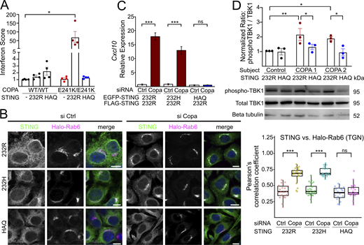 HAQ STING abrogates steady-state STING activation induced by COPA mutation or depletion. (A) Interferon scores calculated from the median fold change in relative quantification values for six ISGs (IFI27, IFI44L, IFIT1, ISG15, RSAD2, and SIGLEC1) (Rice et al., 2013) in 293T cells with WT or CRISPR-edited mutant (E241K) COPA transduced with 232R or HAQ STING. Samples from 232R transduced E241K/E241K COPA cells had significantly elevated interferon scores relative to unmanipulated 293T cells (Friedman test P = 0.181, Dunn’s multiple comparisons P = 0.01). Bars represent mean and standard error of the mean for results from four independent experiments. (B) Confocal microscopy of Sting1 knockout MEFs reconstituted with EGFP-tagged human 232R, 232H, or HAQ STING and treated with Copa-specific siRNA. Both 232R and 232H STING colocalized with HaloTag7-Rab6 (trans-Golgi marker) in Copa knockdown MEFs, while HAQ STING did not. Pearson’s correlation of overlap between STING and Rab6 in the presence of control or Copa siRNA presented to right, based on (in column order from left to right) 20, 24, 26, 21, 18, and 24 cells. Scale bar is 10 μm. (C)Sting1 knockout MEFs were reconstituted with human FLAG-232R plus EGFP-tagged 232R, 232H, or HAQ STING. Copa depletion triggered transcription of the inflammatory chemokine Cxcl10 in MEFs reconstituted with 232R/232R and 232R/232H, while those reconstituted with 232R/HAQ were protected. Bars represent mean and error bars standard deviation for results from three independent experiments. Statistical testing was performed via Student’s unpaired t test. (D) Immunoblotting for TBK1 phosphorylation status was performed for 232R- or HAQ-transduced primary human lung fibroblasts, demonstrating increased phosphorylation (activation) in 232R-transduced patient-derived cells and normalization of phosphorylation in HAQ-transduced fibroblasts. Bars represent means and error bars represent standard error of the mean for results from three independent experiments. Statistical testing was performed via two-way ANOVA (P = 0.0166 for impact of STING in patient cells only). Šídák’s multiple comparisons testing plotted. For all panels: * indicates P < 0.05, **P < 0.01, ***P < 0.001, and ns indicates not significant (P > 0.05). Source data are available for this figure: SourceData F4. Refer to the image caption for details.