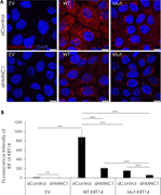 Hemicentin-1 deficiency effect on KIF organization. (A) HaCaT cells grown to 60% confluence on glass coverslips in 12 wells plates were downregulated for HMCN1 with a specific siRNA (siHMCN1) or with a control siRNA (siControl) and co-transfected with an empty vector (EV) or expression vectors encoding either, WT cDNA, or mutant (Mut) KRT14 cDNA carrying the c.373C>T, p.Arg125Cys variant for 48 h at 37°C. The cells were stained for KRT14 expression (red staining) and DAPI (blue staining) (the experiment was repeated two times). Cells were visualized by confocal microscopy. Note protein aggregates in cells transfected with the mutant KRT14 as well as lower expression levels of K14 in siHMCN1-transfected cells (scale bar = 10 μm). (B) K14 KIF fluorescence intensity per cell was measured using ImageJ, analyzing four different zones for each condition. Statistical analysis was performed by t test (***P < 0.005; ****P < 0.001).