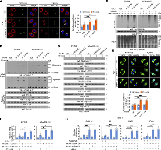 PCK1 S151 phosphorylation attenuates hypoxia-mediated activation of cGAS-STING pathway. (A) Parental BT-549 cells and the indicated clones with knock-in expression of PCK1 S151A mutants treated with or without hypoxia for 6 h were prepared for IF analyses as indicated (left). Scale bar, 20 μm. The co-localization coefficients between the indicated proteins in the presence or absence of hypoxia are shown (right). At least 10 cells from each independent experiment were analyzed, and the representative data are shown (n = 6 biological experiments). (B) Parental BT-549 and MDA-MB-231 cells and the indicated clones with knock-in expression of PCK1 S151A mutants treated with or without hypoxia for 6 h were resolved by native PAGE or SDS-PAGE, followed by immunoblotting analysis as indicated. (C) Parental BT-549 and MDA-MB-231 cells and the indicated clones with knock-in expression of PCK1 S151A mutants transfected with HA-K63-UB and treated with or without hypoxia for 6 h were harvested for IP and immunoblotting analyses as indicated. (D) Parental BT-549 and MDA-MB-231 cells and the indicated clones with knock-in expression of PCK1 S151A mutants treated with or without hypoxia for 6 h were harvested for immunoblotting analyses as indicated. (E) Parental BT-549 cells and the indicated clones with knock-in expression of PCK1 S151A mutants treated with or without hypoxia for 6 h were prepared for IF analyses as indicated (upper). Scale bar, 20 μm. The co-localization coefficients between the indicated proteins in the presence or absence of hypoxia are shown (lower). At least 10 cells from each independent experiment were analyzed, and the representative data are shown (n = 6 biological experiments). (F) Parental BT-549 (left) and MDA-MB-231 (right) cells and the indicated clones with knock-in expression of PCK1 S151A mutants were transiently transfected with vectors expressing β-galactosidase and an IFN-β luciferase reporter. 24 h later, the aforementioned cells treated with or without hypoxia for 6 h were harvested for luciferase assay, and the relative IFN-β luciferase activity after normalization to β-galactosidase activity is shown (n = 4 biological experiments). (G) Parental BT-549 cells and the indicated clones with knock-in expression of PCK1 S151A mutants treated with or without hypoxia for 12 h were harvested for quantitative PCR (qPCR) analyses to measure CXCL10, IL6, IFNB1, and IFNA4 mRNA levels (n = 6 biological experiments). Experiments (B, C, and D) were repeated three times independently with similar results, and the representative data are shown. Statistical significance was determined by two-tailed Student’s t test (A and E–G). Data are the mean ± SD; *P < 0.05, **P < 0.001, and ***P < 0.0001. Source data are available for this figure: SourceData F2. Refer to the image caption for details.