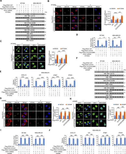 PCK1 S151 phosphorylation–mediated PCK1–cGAS interaction limits cGAS-STING activation via inhibiting cGAS activity. (A) BT-549 and MDA-MB-231 cells expressing PCK1 shRNA with reconstituted expression of Flag-rPCK1 WT or Flag-rPCK1 mutants transfected with or without 2 μg/ml HT-DNA for 6 h were harvested for immunoblotting analyses as indicated. (B and C) BT-549 cells expressing PCK1 shRNA with reconstituted expression of Flag-rPCK1 WT or Flag-rPCK1 mutants transfected with or without 2 μg/ml HT-DNA for 6 h were prepared for IF analyses as indicated (B, left; C, left). Scale bar, 20 μm.The co-localization coefficients between the indicated proteins in the presence or absence of HT-DNA stimulation are shown (B, right; C, right). At least 10 cells from each independent experiment were analyzed, and the representative data are shown (n = 6 biological experiments). (D) BT-549 (left) and MDA-MB-231 (right) cells expressing PCK1 shRNA with reconstituted expression of the indicated PCK1 proteins were transiently transfected with vectors expressing β-galactosidase and an IFN-β luciferase reporter. 24 h later, the aforementioned cells treated with or without 2 μg/ml HT-DNA for 6 h were harvested for luciferase assay, and the relative IFN-β luciferase activity after normalization to β-galactosidase activity is shown (n = 4 biological experiments). (E) MDA-MB-231 cells expressing PCK1 shRNA with reconstituted expression of Flag-rPCK1 WT or Flag-rPCK1 mutants transfected with or without 2 μg/ml HT-DNA for 12 h were harvested for qPCR analyses to measure CXCL10, IL6, IFNB1, and IFNA4 mRNA levels (n = 6 biological experiments). (F) BT-549 and MDA-MB-231 cells expressing PCK1 shRNA with reconstituted expression of Flag-rPCK1 WT or Flag-rPCK1 mutants treated with or without cGAMP for 6 h were harvested for immunoblotting analyses as indicated. (G and H) BT-549 cells expressing PCK1 shRNA with reconstituted expression of Flag-rPCK1 WT or Flag-rPCK1 mutants treated with or without cGAMP for 6 h were prepared for IF analyses as indicated (G, left; H, left). Scale bar, 20 μm.The co-localization coefficients between the indicated proteins in the presence or absence of cGAMP stimulation (G, right; H, right). At least 10 cells from each independent experiment were analyzed and representative data are shown (n = 6 biological experiments). (I) BT-549 (left) and MDA-MB-231 cells (right) expressing PCK1 shRNA with reconstituted expression of Flag-rPCK1 WT or Flag-rPCK1 mutants were transiently transfected with vectors expressing β-galactosidase and an IFN-β luciferase reporter. 24 h later, the aforementioned cells treated with or without cGAMP for 6 h were harvested for luciferase assay, and the relative IFN-β luciferase activity after normalization to β-galactosidase activity is shown (n = 4 biological experiments). (J) MDA-MB-231 cells expressing PCK1 shRNA with reconstituted expression of the indicated PCK1 proteins treated with or without cGAMP for 12 h were harvested for qPCR analyses to measure CXCL10, IL6, IFNB1, and IFNA4 mRNA levels (n = 6 biological experiments). Experiments (A and F) were repeated three times independently with similar results, and the representative data are shown. Statistical significance was determined by two-tailed Student’s t test (B–E and G–J). Data are the mean ± SD; *P < 0.05, **P < 0.001, and ***P < 0.0001; NS, not significant. Source data are available for this figure: SourceData F5. Refer to the image caption for details.