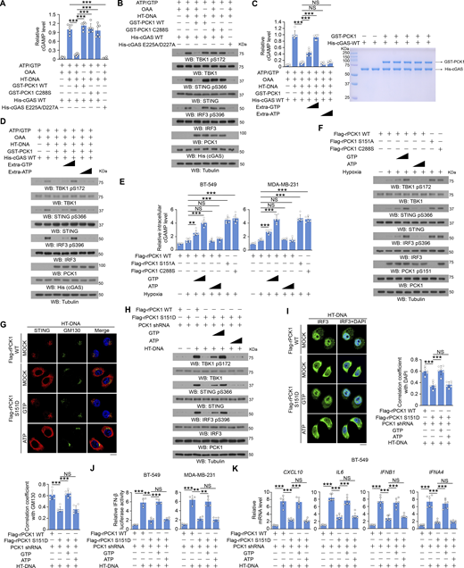 cGAS-associated PCK1 inhibits cGAS activation through competitive consumption of GTP, but not ATP. (A and B) Bacteria-purified cGAS proteins (2 mM) were incubated with HT-DNA (0.2 mg/ml), ATP (2 mM), and GTP (2 mM) in the presence or absence of 2 mM OAA and 2 mM bacteria-purified PCK1 proteins for the in vitro cGAMP production assay (n = 6 biological experiments) (A). After incubation, cGAS was heat inactivated, and products were subject to a cell-based cGAMP activity assay in BT-549 cells. Total cell lysates were harvested for immunoblotting analyses as indicated (B). (C and D) Bacteria-purified cGAS proteins (2 mM) were incubated with HT-DNA (0.2 mg/ml), ATP (2 mM), and different ATP/GTP titrations (2 mM, 4 mM, and 8 mM, respectively) in the presence or absence of 2 mM OAA and 2 mM bacteria-purified PCK1 proteins for the in vitro cGAMP production assay (C, left) (n = 6 biological experiments). The purity of bacteria-purified GST-PCK1 and His-PCK1 WT was identified by Coomassie blue staining (C, right). After incubation, cGAS was heat inactivated, and products were subject to a cell-based cGAMP activity assay in BT-549 cells. Total cell lysates were harvested for immunoblotting analyses as indicated (D). (E and F) BT-549 and MDA-MB-231 cells expressing PCK1 shRNA with reconstituted expression of Flag-rPCK1 WT or Flag-rPCK1 mutants treated with or without hypoxia in the presence or absence of ATP or GTP (0.1 or 0.5 mM) and digitonin (25 mg/ml) for 6 h were harvested for intracellular cGAMP measurement (E) (n = 6 biological experiments). Total cell lysates were harvested for immunoblotting analyses as indicated (F). (G) BT-549 cells expressing PCK1 shRNA with reconstituted expression of Flag-rPCK1 WT or Flag-rPCK1 mutants transfected with or without 2 μg/ml HT-DNA in the presence or absence of 0.5 mM ATP or GTP and digitonin (25 mg/ml) for 6 h were prepared for IF analyses as indicated (upper). Scale bar, 20 μm.The co-localization coefficients between the indicated proteins in the presence or absence of HT-DNA stimulation (lower). At least 10 cells from each independent experiment were analyzed and representative data are shown (n = 6 biological experiments). (H) BT-549 cells expressing PCK1 shRNA with reconstituted expression of Flag-rPCK1 WT or Flag-rPCK1 mutants transfected with or without 2 μg/ml HT-DNA in the presence or absence of 0.5 mM ATP or GTP and digitonin (25 mg/ml) for 6 h were harvested for immunoblotting analyses as indicated. (I) BT-549 cells expressing PCK1 shRNA with reconstituted expression of Flag-rPCK1 WT or Flag-rPCK1 mutants transfected with or without 2 μg/ml HT-DNA in the presence or absence of 0.5 mM ATP or GTP and digitonin (25 mg/ml) for 6 h were prepared for IF analyses as indicated (left). The co-localization coefficients between the indicated proteins in the presence or absence of hypoxia are shown (right). At least 10 cells from each independent experiment were analyzed, and the representative data are shown (n = 6 biological experiments). (J) BT-549 (left) and MDA-MB-231 (right) cells expressing PCK1 shRNA with reconstituted expression of Flag-rPCK1 WT or S151D mutant were transiently transfected with vectors expressing β-galactosidase and an IFN-β luciferase reporter. 24 h later, the aforementioned cells transfected with or without 2 μg/ml HT-DNA in the presence or absence of 0.5 mM ATP or GTP and digitonin (25 mg/ml) for 6 h were harvested for luciferase assay, and the relative IFN-β luciferase activity after normalization to β-galactosidase activity is shown (n = 4 biological experiments). (K) BT-549 cells expressing PCK1 shRNA with reconstituted expression of Flag-rPCK1 WT or S151D mutant transfected with or without 2 μg/ml HT-DNA in the presence or absence of 0.5 mM ATP or GTP and digitonin (25 mg/ml) for 12 h were harvested for qPCR analyses to measure CXCL10, IL6, IFNB1, and IFNA4 mRNA levels (n = 6 biological experiments). Experiments (B, D, F, and H) were repeated three times independently with similar results, and the representative data are shown. Statistical significance was determined by two-tailed Student’s t test (A, C, E, G, and I–K). Data are the mean ± SD; **P < 0.001 and ***P < 0.0001; NS, not significant. Source data are available for this figure: SourceData F6. Refer to the image caption for details.