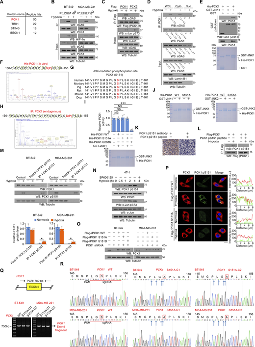 JNK1/2-mediated PCK1 S151 phosphorylation promotes its binding to cGAS upon hypoxic conditions. (A) BT-549 cells were treated with or without hypoxia for 2 h. An IP assay was performed using an anti-cGAS antibody, and immunoprecipitates of endogenous cGAS were separated using SDS-PAGE and stained with Coomassie brilliant blue. Selected peptide hits of proteins associated with cGAS identified through mass spectrometry are shown. (B) BT-549 and MDA-MB-231 cells treated with hypoxia for 2 h were harvested for IP and immunoblotting analyses as indicated. (C) BT-549 cells expressing Flag-PCK1 or Flag-PCK2 treated with or without hypoxia for 2 h were harvested for IP and immunoblotting analyses as indicated. (D) BT549 cells were treated with or without hypoxia for 2 h. Cytosolic and nuclear fractions were prepared for IP and immunoblotting analyses as indicated, and the relative PCK1 and cGAS protein level in different fractions was quantified by densitometric analysis of the blots. (E) Bacterially purified His-PCK1 incubated with bacterially purified GST or GST-JNK1 was prepared for the GST pull-down assay. Immunoblotting analyses were performed as indicated (upper), and Coomassie blue staining was performed to show the purity of proteins (lower). (F) Bacterially purified His-PCK1 proteins on Ni-NTA agarose beads were incubated with or without active GST-JNK1 in the presence of ATP for an in vitro kinase assay. Mass spectrometric analysis of a tryptic fragment at m/z 1002.98499 Da (+2.63 mmu/+2.62 ppm), which was matched with the +2 charged peptide 138-TMYVIPFSMGPLGSPLSK-155, suggested that S151 was phosphorylated. The XCorr score was 5.56. (G) Alignment of protein sequences spanning PCK1 S151 from different species. (H) BT-549 cells treated with or without hypoxia for 1 h for the IP assay using an anti-PCK1 antibody, and IP of endogenous PCK1 were separated using SDS-PAGE, stained with Coomassie brilliant blue, and subjected to LC-MS/MS analysis. Mass spectrometric analysis of a tryptic fragment at m/z 610.87012 Da (−4.69 mmu/−7.68 ppm), which was matched with the +5 charged peptide 130-FPGCMKGRTMYVIPFSMGPLGSPLSK-155, suggested that S151 was phosphorylated. The XCorr score was 3.2. (I) Bacterially purified His-PCK1 WT, S151A, or C288S on Ni-NTA agarose beads were incubated with or without purified active GST-JNK1 in the presence of ATP for an in vitro kinase assay. After washing His-PCK1 WT, S151A, or C288S-conjugated beads with PBS five times, the relative PCK1 activity was measured (upper), and Coomassie blue staining was performed to show the purity of bacterially purified proteins (lower). (J) The purity of bacterially purified proteins used in In vitro kinase assays was identified by Coomassie blue staining. (K) IHC analyses of human TNBC samples were performed with the indicated antibodies in the presence or absence of a blocking peptide for PCK1 S151. (L) BT-549 cells expressing Flag-PCK1 treated with or without hypoxia for 1 h were harvested for IP and immunoblotting analyses as indicated in the presence or absence of a blocking peptide for PCK1 S151. (M) BT-549 and MDA-MB-231 cells treated with hypoxia for 2 h were harvested for IP and immunoblotting analyses as indicated (upper), and the relative PCK1 protein level in different fractions was quantified by densitometric analysis of the blots (lower). (N) 4T-1 cells pretreated with or without SP600125 (20 μM) or for 30 min before treatment with or without hypoxia for the indicated time were harvested for immunoblotting analyses as indicated. (O) BT-549 and MDA-MB-231 cells expressing PCK1 shRNA with reconstituted expression of the indicated PCK1 proteins were harvested for immunoblotting analyses as indicated. (P) BT-549 cells expressing PCK1 shRNA with reconstituted expression of the indicated PCK1 proteins treated with or without hypoxia for 2 h were prepared for IF analyses as indicated (left). Scale bar, 20 μm. The intensity of green (PCK1 pS151) or red (PCK1) fluorescent signals along the oblique line were measured using Image J (right). At least n = 30 cells from the experiment were analyzed, and representative data are shown. (Q) Genomic DNA was extracted from two individual clones of parental BT-549 and MDA-MB-231 cells with knock-in expression of PCK1 S151A. PCR products amplified from the indicated DNA fragments were separated on an agarose gel. (R) Sequencing of parental BT-549 and MDA-MB-231 cells and the individual clones of parental cells with knock-in expression of PCK1 S151A. The red line indicates the sgRNA-targeting sequence. The black line indicates the protospacer adjacent motif (PAM). Blue arrows indicate mutated nucleotides. A mutated amino acid and its WT counterpart are indicated by the solid red box. Experiments (B–E and L–O) were repeated three times independently with similar results, and the representative data are shown. Data are representative of as mean ± SD. Statistical significance was determined by two-tailed Student’s t test (I and M); *P < 0.05 and ***P < 0.0001; NS, not significant. Source data are available for this figure: SourceData FS1. Refer to the image caption for details.