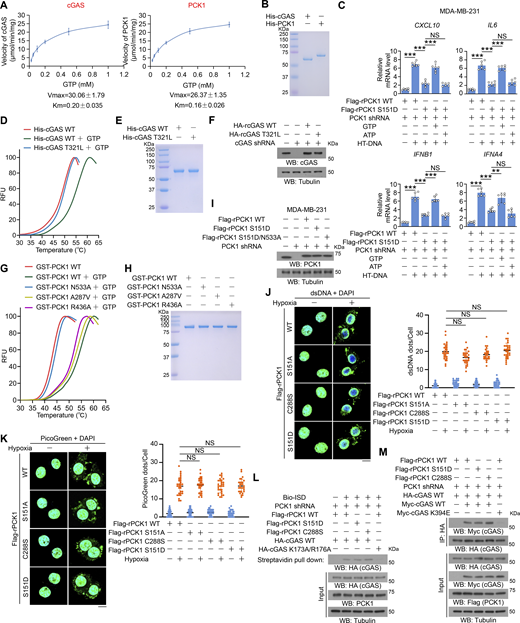 The GTP-binding affinity of PCK1 and cGAS is indispensable for PCK1 S151 phosphorylation–mediated cGAS-STING inhibition. (A and B) Enzymatic kinetic plot of His-cGAS and His-PCK1 toward GTP is presented (A) (n = 3 biological experiments), and Coomassie blue staining (B) was performed to show the purity of bacterially purified proteins in A. (C) MDA-MB-231 cells expressing PCK1 shRNA with reconstituted expression of Flag-rPCK1 WT or S151D mutant transfected with or without 2 μg/ml HT-DNA in the presence or absence of 0.5 mM ATP or GTP and digitonin (25 mg/ml) for 12 h were harvested for qPCR analyses to measure CXCL10, IL6, IFNB1, and IFNA4 mRNA levels (n = 6 biological experiments). (D) The thermal stability of His-cGAS WT or T321L mutant was detected by TSA. RFU, relative fluorescence units. (E) The purity of bacterially purified His-cGAS WT and T321L mutant was analyzed by Coomassie blue staining. (F) MDA-MB-231 cells expressing PCK1 shRNA and cGAS shRNA with reconstituted expression of the indicated PCK1 or cGAS proteins were harvested for immunoblotting analyses as indicated. (G) The thermal stability of GST-PCK1 WT or GST-PCK1 N533A, A287V, or R436A mutants was detected by TSA. RFU, relative fluorescence units. (H) The purity of bacterially purified GST-PCK1 WT or GST-PCK1 N533A, A287V, or R436A mutants was analyzed by Coomassie blue staining. (I) MDA-MB-231 cells expressing PCK1 shRNA with reconstituted expression of Flag-rPCK1 WT or Flag-rPCK1 mutants were harvested for immunoblotting analyses as indicated. (J and K) BT-549 cells expressing PCK1 shRNA with reconstituted expression of Flag-rPCK1 WT or Flag-rPCK1 mutants treated with or without hypoxia for 6 h were prepared for IF analyses with an anti-dsDNA–specific antibody (J, left) or 3 μl/ml PicoGreen staining (K, left). Scale bar, 20 μm. Graphical representation shows dsDNA and PicoGreen quantitation, respectively (J and K, right). At least n = 30 cells from each independent experiment were analyzed and representative data are shown. (L) BT-549 cells expressing PCK1 shRNA with reconstituted expression of Flag-rPCK1 WT or Flag-rPCK1 mutants transfected with HA-tagged WT or DNA-binding defective mutant (K173A/R176A) were harvested for the biotin pull-down assay to measure the DNA-binding ability of cGAS. ISD indicates IFN stimulatory DNA. (M) BT-549 cells expressing PCK1 shRNA with reconstituted expression of Flag-rPCK1 WT or Flag-rPCK1 mutants transfected with Myc-tagged WT or cGAS K394E were harvested for IP and immunoblotting analyses as indicated. Experiments (D–I, L, and M) were repeated three times independently with similar results, and the representative data are shown. Data are representative of as mean ± SD. Statistical significance was determined by two-tailed Student’s t test (C), two-way ANOVA, followed by Tukey’s test (J and K); **P < 0.001 and ***P < 0.0001; NS, not significant. Source data are available for this figure: SourceData FS4. Refer to the image caption for details.