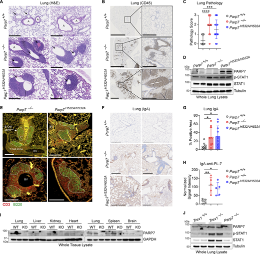 PARP7 maintains lung immune homeostasis. (A) Representative H&E staining of the lung from 10-mo-old WT, Parp7−/−, and Parp7H532A/H532A mice. Black arrows, blood vessels; A, airways. Scale bars, 500 μm. (B) Representative IHC staining of CD45 in the lung from 10-mo-old WT, Parp7−/−, and Parp7H532A/H532A mice. Scale bars, 2.5 mm or 500 μm (inset). (C) Histopathological scoring of the lung from 10-mo-old WT (n = 17), Parp7−/− (n = 11), and Parp7H532A/H532A (n = 21) mice. (D) Western blot analysis of indicated protein from whole lung lysate from 10-mo-old WT, Parp7−/−, and Parp7H532A/H532A mice. (E) Representative IF staining of T cells (CD3, red) and B cells (B220, green) in the lung from 10-mo-old WT, Parp7−/−, and Parp7H532A/H532A mice. B cell zones are outlined by white dashed line. BV, blood vessels. Scale bars, 200 μm. (F) Representative IHC staining of IgA in the lung from 10-mo-old WT, Parp7−/−, and Parp7H532A/H532A mice. Scale bars, 500 μm. (G) Percent IgA positive area of the lung from 10-mo-old WT (n = 9), Parp7−/− (n = 10), and Parp7H532A/H532A (n = 10) mice. (H) Serum IgA anti-PL-7 from 10-mo-old WT, Parp7−/−, and Parp7H532A/H532A mice (n = 5). (I) Western blot analysis of PARP7 in whole tissue lysates from the lung, liver, kidney, heart, spleen, and brain. (J) Western blot analysis of PARP7 in whole lung lysate from WT and Trex1−/− littermate control mice. Data are shown as mean ± SD. P values were determined by one-way ANOVA (C, G, and H). *P < 0.05, **P < 0.01, ***P < 0.001, ****P < 0.0001, and ns, not significant. Data are representative of three independent experiments. Source data are available for this figure: SourceData F5. Refer to the image caption for details.
