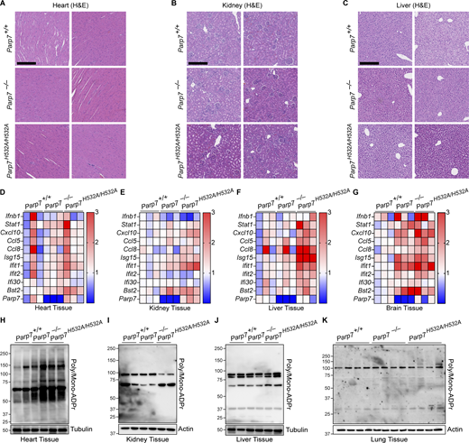 Tissue pathology, ISG signature, and ADP-ribose levels. (A–C) Representative H&E staining of the heart (A), kidney (B), and liver (C) from 10-mo-old WT, Parp7−/−, and Parp7H532A/H532A mice. (D–G) A heat map showing qRT-PCR analysis of the expression of various ISGs (left) in the heart (D), kidney (E), liver (F), and brain (G) from 10-mo-old WT, Parp7−/−, and Parp7H532A/H532A mice (n = 3). (H–K) Western blot analysis of whole tissue ADP-ribose levels in the heart (H), kidney (I), liver (J), and lung (K) from WT, Parp7−/−, and Parp7H532A/H532A mice (n = 3 for heart, kidney, and liver or n = 4 for lung). Data are representative of two independent experiments. Source data are available for this figure: SourceData FS4. Refer to the image caption for details.