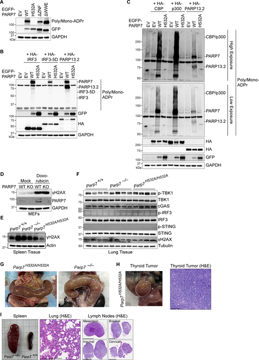 IRF3 and CBP/p300 MARylation analysis, DNA damage in mouse tissues, and incidental findings in mice. (A) Western blot analysis of PARP7 auto-MARylation. PARP7 mutants (as indicated on top) were overexpressed in HEK293T cells followed, by blotting with indicated antibodies. (B) Western blot analysis of ADP-ribose in whole cell lysates. Empty vector (EV), EGFP-PARP7, or EGFP-PARP7-H532A was co-expressed with either HA-IRF3, HA-IRF3-5D, or HA-PARP13.2 (as indicated on top) in HEK293T cells, followed by blotting with indicated antibodies. (C) Western blot analysis of ADP-ribose in whole cell lysates. EV, EGFP-PARP7, or EGFP-PARP7-H532A was co-expressed with either HA-CBP, HA-p300, or HA-PARP13.2 (as indicated on top) in HEK293T, followed by blotting with indicated antibodies. Data are representative of at least three independent experiments. (D) Western blot analysis of DNA damage. WT and Parp7−/− MEFs were treated with mock or doxorubicin (1 μM, 6 h), followed by analysis for γH2AX. (E) Western blot analysis of γH2AX in the spleen from WT, Parp7−/−, and Parp7H532A/H532A mice (n = 2). (F) Western blot analysis of cGAS–STING pathway components and DNA damage in the lung from WT, Parp7−/−, and Parp7H532A/H532A mice (n = 4). Data are representative of two independent experiments. (G) Photo of pyometra (outlined in white dashed line) of 10-mo-old female Parp7H532A/H532A and Parp7−/− mouse. (H) Photo of noninvasive thyroid tumor (outlined in white dashed lines) and cervical lymph nodes (outlined in green dashed lines) of a 10-mo-old female Parp7H532A/H532A mouse. H&E staining of the thyroid tumor. Scale bar, 100 μm. (I) Photo of spleen of 10-mo-old Parp7−/− mouse compared with WT littermate mouse. H&E staining of the lung and lymph nodes from Parp7−/− mouse. Scale bars, 250 μm. Pathology is suggestive of lymphoma for H and I. Source data are available for this figure: SourceData FS5.
