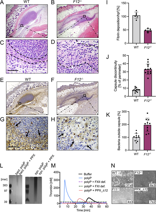 Defective S. aureus polyP-mediated fibrin formation and impaired fibrous abscess capsule integrity in F12−/−mice. (A–H) WT, F12−/− mice were subcutaneously inoculated with 3 × 106 CFU S. aureus, and abscesses were removed 30 h after infection. Representative photographs of skin sections stained with (A–D) H&E or (E–H) fibrin-specific antibody 59D8 are shown. Dashed lines and black arrows denote abscess capsule and fibrin staining around the abscess, respectively. Scale bars represent 50 µm. (I) Quantification of fibrin staining given in % relative to WT mice. (J) Integrity of abscess capsule measured from immunohistochemistry sections by gaps within the discontinuous fibrin layer of the abscess capsule given relative to the abscess perimeter. (K) Number of S. aureus detected in the peripheral zone of the abscess given in relative to bacteria counts detected in WT mice, set to 100%. Images were analyzed with ImageJ software. Each symbol represents an individual animal. (L) PolyP was extracted from S. aureus by anion exchanger chromatography, separated on polyacrylamide/urea gel and visualized by DAPI-negative staining. Synthetic polyP with mean chain lengths of 39, 97, and 383 phosphate monomers served as molecular size standard. Purified polyP was loaded without and after incubation with PPX (10 U/ml for 2 h). A representative gel of n = 3 is shown. (M) Real-time thrombin generation in normal human plasma stimulated with S. aureus–derived polyP in the absence or presence of PPX_Δ12 (1 mg/ml). Plasma deficient in FXII (FXII def.) or FXI (FXI def.) and buffer-stimulated normal plasma was blotted for comparison. Representative thrombin generation curves of a series of n = 3. (N) Citrated whole mouse blood, readjusted to physiological Ca2+ and Mg2+ concentrations, was perfused over a surface coated with 3 × 106 CFU S. aureus at a venous (100 s−1) shear rate. Representative phase-contrast images of thrombi formed during perfusion of WT, F12−/−, F11−/−, or PPX_Δ12 -treated WT blood are shown. Surface covered area by all thrombi in % is given in the lower right corner. A representative experiment of n = 3 is shown. Source data are available for this figure: SourceData F4.