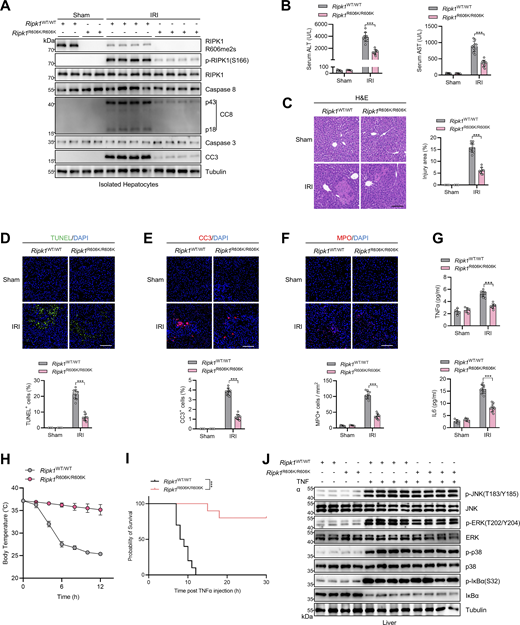 Ripk1R606K/R606Kmice exhibited mitigated RIPK1-driven liver IRI and SIRS. (A–G)Ripk1WT/WT or Ripk1R606K/R606K mice underwent 1-h ischemia/6-h reperfusion operation. The levels of RIPK1 R606me2s, p-RIPK1(S166), CC8, CC3 in isolated hepatocytes were determined by immunoblotting (A). Serum ALT/AST detection (B) and liver H&E staining (C) were performed; liver TUNEL staining (D), CC3 immunostaining (E), MPO immunostaining (F), and serum proinflammatory cytokine detection (G) were performed. Scale bar: 100 μm (C–F). (H–J) 500 μg/kg TNFα was intravenously injected to Ripk1WT/WT or Ripk1R606K/R606K mice. Body temperature (H) and survival time (I) were compared. NF-κB and MAPK activation in liver was analyzed with immunostaining (J). Data are represented as the mean ± SD (B–H). Data are representative of n = 3 independent experiments (A–J). Statistical significance was determined using two-way ANOVA with post hoc Bonferroni’s test (B–H) or log-rank test (I). ***P < 0.001. Source data are available for this figure: SourceData F10.