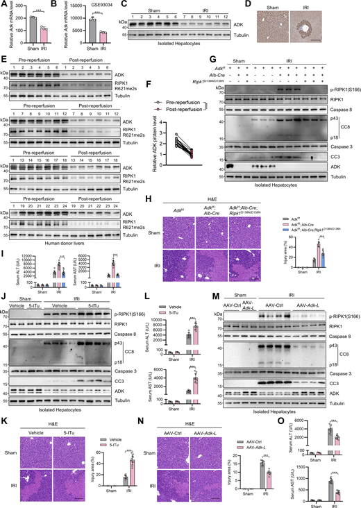 ADK expression reduction promotes liver IRI. (A) RNA-seq revealed the mRNA level of ADK after IRI in mouse liver tissue. (B) ADK mRNA level in mouse liver IRI transcriptome dataset GSE93034 was shown. (C and D) Protein levels of ADK after IRI in mouse livers were detected by immunoblotting and immunohistochemistry. Scale bar: 200 μm (D). (E and F) ADK protein levels were detected in donor livers before reperfusion or after reperfusion by immunoblotting (E). Comparison of protein expression levels of ADK before and after reperfusion (F). n = 24 for donor livers (F). (G–I)Adkf/f, Adkf/f;Alb-Cre, or Adkf/f;Alb-Cre;Ripk1D138N/D138N mice underwent 1-h ischemia/6-h reperfusion operation at the age of 5 wk. The levels of p-RIPK1(S166), CC8, CC3, and ADK in isolated hepatocytes were determined by immunoblotting (G). Liver H&E staining (H) and serum ALT/AST detection (I) were performed. Scale bar: 100 μm (H). (J–L) Vehicle or 5-ITu (20 mg/kg) was injected intraperitoneally to WT mice at the age of 8 wk. 1 h after the injection, the mice underwent 1-h ischemia/6-h reperfusion operation. The levels of p-RIPK1(S166), CC8, CC3, and ADK were determined by immunoblotting (J). Liver H&E staining (K) and serum ALT/AST detection (L) were performed. Scale bar: 100 μm (K). (M–O) AAV8 that was expressing Adk-L or control was injected to WT mice through tail vein. 1 mo after the injection, the mice underwent 1-h ischemia/6-h reperfusion operation. The levels of p-RIPK1(S166), CC8, CC3, and ADK were determined by immunoblotting (M). Liver H&E staining (N) and serum ALT/AST detection (O) were performed. Scale bar: 100 μm (N). Data are represented as the mean ± SD (A, B, H, I, K, L, N, and O). Data are representative of n = 3 independent experiments (A–O). Statistical significance was determined using unpaired two-tailed Student’s t test (A and B), paired two-tailed Student’s t test (F), or two-way ANOVA with post hoc Bonferroni’s test (H, J, K, L, N, and O). ***P < 0.001. Source data are available for this figure: SourceData F8. Refer to the image caption for details.