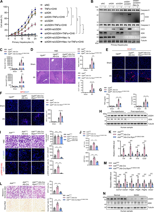 ADK expression reduction aggravates liver IRI. (A and B) Primary hepatocytes from WT mice were treated with CHX (1 μM)/TNFα (10 ng/ml) for the indicated time (A) or 12 h (B). Cell death was measured by the SYTOX Green positivity assay (A). The levels of p-RIPK1(S166), CC8, and CC3 were determined by immunoblotting (B). (C–G)Ugdhf/f, Ugdhf/f;Alb-Cre, Ugdhf/f;Alb-Cre;Ripk1D138N/D138N mice were subjected to 1-h ischemia/6-h reperfusion model. Serum ALT/AST detection (C), H&E staining (D), CC3 immunostaining (E), MPO immunostaining (F), and serum TNFα and IL-6 level detection (G) were performed. Scale bar: 100 μm (D–F). (H) Protein expression level of UGDH and ADK in clinical donor liver IRI samples was analyzed with immunoblotting. (I–M)AdkWT/f, AdkWT/f;Alb-Cre, AdkWT/f;Alb-Cre;Ripk1D138N/D138N mice were fed with choline-deficient high-fat diet (60% fat, 0.1% methionine, and no added choline, A06071302; Research Diets) for 6 wk to construct the NASH model. Liver H&E staining, CC3 immunostaining, and p-RIPK1 (S166) immunostaining were performed (I), serum ALT/AST was measured (J), proinflammatory gene expression was analyzed (K), liver fibrosis was analyzed with Masson’s trichrome staining and Sirius red staining (L), and fibrotic gene expression was analyzed (M). Scale bar: 100 μm (I and L). (N) Protein expression level of UGDH and ADK in clinical NASH samples was analyzed with immunoblotting. Data are represented as the mean ± SD of n = 3 (A, C–G, and I–M). Data are representative of n = 3 independent experiments (A–N). Statistical significance was determined using two-way ANOVA with post hoc Bonferroni’s test (C–G, K, and M) or one-way ANOVA with post hoc Dunnett’s test (I, J, and L). *P < 0.05; ***P < 0.001. Source data are available for this figure: SourceData FS5.