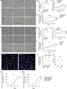 Inhibition of LISRR enhances anti-melanoma immune responses. (A) Representative pictures of HLA-matched PBMCs (red) stimulated with IL-2 and cocultured with MM099 melanoma cell line upon LISRR KD using ASOs. Caspase-3+ cells are in green/yellow. (B) Efficiency of LISRR KD calculated by RT-qPCR and expressed as fold changes (FC) compared with Ctrl ASO. The dots in the histograms indicate the number of biological replicates (n = 3). *** indicating P ≤ 0.001 and ns values were calculated by one-way ANOVA. (C) Analysis of MM099 confluency (%) transfected with LISRR ASO, ASO control (Ctrl ASO), or not transfected (Mock) and cocultured with PBMCs stimulated with IL-2 only (n = 3). *P ≤ 0.05 and ** indicating P ≤ 0.01 were calculated by two-way ANOVA mixed effect. (D) Analysis of caspase-3 counts in MM099 transfected as indicated in A and cocultured with PBMCs stimulated with IL-2 only. **** indicating P ≤ 0.0001 was calculated by two-way ANOVA mixed effect. (E) Representative pictures of MM099 transfected with siRNAs against LISRR (siLISRR), nontargeting control (siControl), or not transfected (Mock) and cocultured with PBMCs (in red) stimulated with a T cell activating cocktail. Caspase-3+ cells are in green/yellow. (F) Efficiency of LISRR KD in experiment E, calculated by RT-qPCR and expressed as FC compared with Ctrl ASO. The dots in the histograms indicate the number of biological replicates (n = 3). *** indicating P ≤ 0.001 and *P ≤ 0.05 were calculated by one-way ANOVA. (G) MM099 confluency in the experiment in E. **** indicating P ≤ 0.0001 was calculated by two-way ANOVA mixed effect. (H) Caspase counts in the experiment in E. *P ≤ 0.05 and ** indicating P ≤ 0.01 were calculated by two-way ANOVA mixed effect. (I) Confocal images of MM099 and PBMCs cocultures in E (n = 3). In blue nuclei, CD4+ and CD8+ cells are in magenta and in yellow, respectively. (J) Quantification of confocal images from the experiment in I. Average counts of CD4+ and CD8+ per images per biological replicate are shown (n = 3). Statistics (ns) calculated by two-way ANOVA. (K) Ratio of CD8+/CD4+ cells from the experiment in I. Statistics (ns) calculated by t test. (L) Caspase counts in coculture of CD8+ cells with MM099 transfected as indicated in E and treated with α-PD1 (n = 3). *P ≤ 0.05 and ns were calculated by two-way ANOVA mixed effect analysis. (M) Caspase counts in coculture of CD4+ cells with MM099 transfected as indicated in E and treated with α-PD1 (n = 3). *P ≤ 0.05, **P ≤ 0.01, and ****P ≤ 0.0001 were calculated by two-way ANOVA mixed effect analysis.