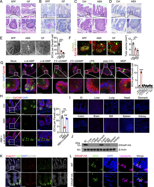 ERAdP promotes DCV generation in Paneth cells via c-di-AMP stimulation. (A) HE staining of intestines from SPF and GF mice. Scale bar: 20 μm. (B) AB-PAS staining of intestines from SPF and GF mice. Scale bar: 20 μm. (C) HE staining of intestines from control and ABX mice. Scale bar: 20 μm. ABX mice were treated with 2-wk antibiotic, and control mice were treated with water. (D) AB-PAS staining of intestines from control and ABX mice. Scale bar: 20 μm. ABX mice and control mice were treated as in C. (E) Left: Electron micrograph of SPF, ABX, and GF mice. Paneth cells were drawn with dashed white lines, normal DCVs were indicated by yellow asterisk, and abnormal DCVs were indicated by red asterisk. Scale bar: 5 μm. Right: Numbers of DCVs per Paneth cells in SPF, ABX, and GF mice were calculated (n = 10 mice for each group). (F) Left: 3D immunofluorescence staining of ileum crypts from littermate SPF, ABX, and GF mice. Green: UEA-1, red: EpCAM, and yellow: DCVs’ surface fitted by Imaris 9 software. Scale bar: 35 μm. Right: Volume of DCVs was quantified (n = 6 mice for each group). (G) Left: Immunofluorescence staining of intestinal organoids treated with mock, or different stimulations of PRRs: 10 μΜ c-di-AMP disodium, 10 μΜ c-di-GMP disodium, 10 μΜ 3′3′-cGAMP disodium, 10 μΜ 2′3′-cGAMP disodium, 10 μg/ml LPS, 10 μg/ml poly (I:C) sodium, and 2 μg/ml MDP for 16 h. Green: UEA-1, blue: DAPI, and red: EpCAM. Scale bar: 20 μm. Right: Number of DCVs per Paneth cells was quantified (n = 6 mice for each group). (H) Left: Immunofluorescence staining of ileums from mice of control, ABX mock treated, or treated through intragastric gavage with c-di-AMP (25 mg/kg for mouse) twice, with treatments 12 h apart. Green: UEA-1; blue: DAPI, red: EpCAM. Scale bar: 20 μm. Right: Number of DCVs per Paneth cells was quantified (n = 6 mice for each group). (I)Cnep1r1 FISH of 10 different tissues of WT mice. Red: Cnep1r1 probes; blue: DAPI. Scale bar: 35 μm. (J) ERAdP expression levels of indicated tissues from ERAdP-HA tag mice were detected by western blot using anti-HA antibody. β-Actin was used as a loading control. (K)Cnep1r1 FISH of intestine of Lgr5-EGFP mice. Red: Cnep1r1 probes, green: Lgr5EGFP, blue: DAPI, and gray: EpCAM. Scale bar: 35 μm. (L) Immunofluorescence staining showing ERAdP subcellular localization in intestines from ERAdP-HA or WT mice. Red: HA, green: WGA, blue: DAPI, and pink: lysozyme. Scale bar: 15 μm. Data in E–H are shown as means ± SEM, then significance was determined by unpaired two-tailed Student’s t test (*P < 0.05; **P < 0.01; ***P < 0.001; ns, not significant). Data above are representative of at least three independent experiments. Source data are available for this figure: SourceData F1.