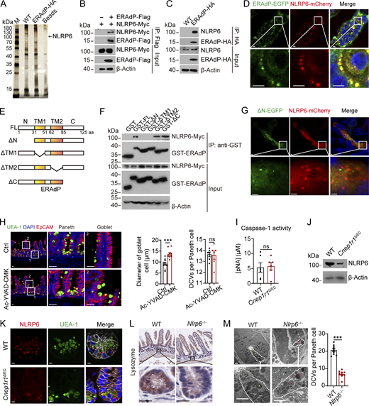 ERAdP interacts with NLRP6. (A) Immunoprecipitation assay was performed using small intestinal crypts from WT and ERAdP-HA mice. Crypts were lysed and incubated with anti-HA antibody and protein A/G beads or only protein A/G beads as control. Proteins precipitated on the beads were resolved by SDS-PAGE, followed by silver staining, and differential bands were cut for mass spectrometry. The band of NLRP6 was shown. (B) co-IP analysis of NLRP6-Myc and ERAdP-Flag. NLRP6-Myc and ERAdP-Flag were cotransfected into HEK293T cells for 48 h. Cell lysates were incubated with anti-Flag antibody for immunoprecipitation; proteins precipitated on the beads were analyzed by western blotting with anti-Myc and anti-Flag antibodies. β-Actin was used as a loading control. (C) Endogenous co-IP of NLRP6 and ERAdP-HA. Small intestinal crypts from WT and ERAdP-HA mice were lysed and incubated with anti-HA antibody and protein A/G beads. Proteins precipitated on the beads were analyzed with anti-NLRP6 and anti-HA antibodies. β-Actin was used as a loading control. (D) Colocalization analysis of ERAdP-EGFP and NLRP6-mCherry. ERAdP-EGFP and NLRP6-mCherry were cotransfected into Caco-2 cell line, and colocalization was analyzed with fluorescence imaging. Scale bar: 7.5 μm. (E and F) Domain mapping analysis of NLRP6-binding domains of ERAdP protein. Schematic diagram showing truncation mutants of ERAdP (E). FL, full-length; N: N-terminal; TM1, transmembrane 1, TM2, transmembrane 2; C, C-terminal. NLRP6-Myc were transfected into HEK293T cells for 48 h. Cell lysates were incubated with different truncation mutants of GST-ERAdP recombinant protein and GST beads. Proteins precipitated on the beads were analyzed with anti-Myc and anti-GST antibodies. β-Actin was used as a loading control (F). (G) Colocalization analysis of ΔN-ERAdP-EGFP and NLRP6-mCherry. Truncation mutant forms of ΔN-ERAdP-EGFP and NLRP6-mCherry were cotransfected into Caco-2 cell line, and colocalization was analyzed with fluorescence imaging. Scale bar: 3.5 μm. (H) Left: Immunofluorescence staining of SIs from mice administered with DMSO or Ac-YVAD-CMK. Representative Paneth cells and goblet cells are shown. Green: UEA-1; blue: DAPI, red: EpCAM. Scale bar: 20 μm. Right: Diameter of WGA+ cells (n = 10 mice and 20 villus-crypts were analyzed per mouse) and DCVs per Paneth cells were quantified (n = 6 mice and 20 villus-crypts were analyzed per mouse). (I) ELISA of caspase-1 activity examination of crypts from WT and Cnep1r1ΔIEC mice (n = 6 mice for each group). (J) NLRP6 expression levels of SI crypts from littermate WT and Cnep1r1ΔIEC mice were detected by western blot with anti-NLRP6 antibody. β-Actin was used as a loading control. (K) Immunofluorescence staining of ileum crypts from littermate WT and Cnep1r1ΔIEC mice. Red: NLRP6, green: UEA-1, blue: DAPI, and gray: EpCAM. Scale bar: 5 μm. (L) Immunohistochemistry staining of lysozyme in intestines from WT and Nlrp6−/− mice. Scale bar: 35 μm. (M) Left: Electron micrograph of small intestinal crypts in littermate WT and Nlrp6−/− mice. Paneth cells were drawn with dashed white lines, normal DCVs were indicated by yellow asterisk, and abnormal DCVs were indicated by red asterisk. Scale bar: 5 μm. Right: Number of DCVs was calculated (n = 10 mice for each group). Data in H, I, and M are expressed as means ± SEM, then significance was determined by unpaired two-tailed Student’s t test (***P < 0.00; ns, not significant). Data in A–D and F–M are representative of at least three independent experiments. Source data are available for this figure: SourceData F4. Refer to the image caption for details.