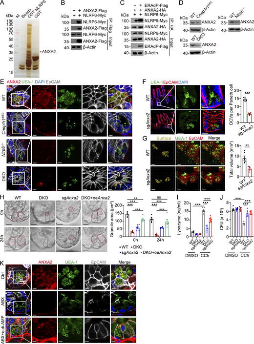 The ERAdP–NLRP6 association recruits ANXA2 onto the DCV membrane for generation of DCVs. (A) GST pull-down showing interaction of NLRP6 and ANXA2. Lysed small intestinal crypts from WT mice were incubated with GST-NLRP6 recombinant protein or GST recombinant protein as control. Proteins precipitated on the beads were resolved by SDS-PAGE, followed by silver staining, and differential bands were cut for mass spectrometry. Representative protein ANXA2 is shown. (B) co-IP analysis of NLRP6-Myc and ANXA2-Flag. NLRP6-Myc and ANXA2-Flag were cotransfected into HEK293T cells for 48 h. Cell lysates were incubated with anti-Flag antibody for immunoprecipitation; proteins precipitated on the beads were analyzed by western blotting with anti-Myc and anti-Flag antibodies. β-Actin was used as a loading control. (C) co-IP analysis of NLRP6-Myc and ANXA2-HA under the condition of absence or presence of ERAdP-Flag. β-Actin served as a loading control. (D) Western blot showing ANXA2 expression levels of SI crypts from littermate WT, Cnep1r1ΔIEC, Nlrp6−/−, and ERAdP–NLRP6 DKO mice with anti-ANXA2 antibody. β-Actin was used as a loading control. (E) Immunofluorescence staining showing ANXA2 localization in ileum crypts from littermate WT, Cnep1r1ΔIEC, Nlrp6−/−, and DKO mice. Red: ANXA2, green: UEA-1, blue: DAPI, and gray: EpCAM. Scale bar: 5 μm. (F) Left: Immunofluorescence staining showing DCVs in Paneth cells from littermate WT and sgAnxa2 mice. Green: UEA-1, red: EpCAM, and blue: DAPI. Scale bar: 20 μm. Right: Number of DCVs per Paneth cells was quantified (n = 6 mice for each group). (G) Left: 3D immunofluorescence staining of ileum crypts from WT and sgAnxa2 mice. Green: UEA-1; red: EpCAM; yellow: DCVs’ surface fitted by Imaris 9 software. Scale bar: 20 μm. Right: Volume of DCVs was quantified (n = 6 mice for each group). (H) Left: DIC images of organoids from WT, Cnep1r1ΔIEC, DKO, sgAnxa2, and ANXA2-overexpressing DKO mice. Organoids were stimulated by CCh for 10 min and then washed out. Images were captured before (0 h) and after CCh stimulation (24 h). Areas of DCV were drawn with dashed red lines, and the corresponding Paneth cells were drawn with dashed black lines. Scale bar: 10 μm. Right: Area of DCVs was quantified (n = 6 mice for each group). (I) Lysozyme in supernatant of stimulated crypts from WT, DKO, and sgAnxa2 mice after treatment of DMSO or CCh was measured by ELISA (n = 6 mice for each group). (J) Bacterial load analysis of S. Typhimurium in crypt supernatants. SI crypts of littermate WT, DKO and sgAnxa2 mice were isolated and stimulated by DMSO or CCh. The crypt supernatants were incubated with S. Typhimurium, and CFU was measured (n = 6 mice for each group). (K) Immunofluorescence staining of ileum crypts from mice of control, ABX mock treated, or treated through intragastric gavage with c-di-AMP. Green: UEA-1, blue: DAPI, red: ANXA2, and gray: EpCAM. Scale bar: 10 μm. Data in F–J are shown as means ± SEM, then significance was determined by unpaired two-tailed Student’s t test (**P < 0.01; ***P < 0.001; ns, not significant). Data above are representative of at least three independent experiments. Source data are available for this figure: SourceData F5.