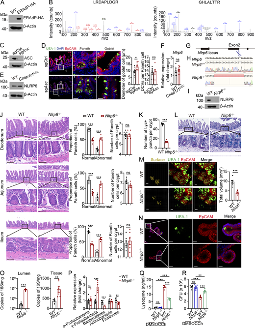 Identification of NLRP6 and generation of NLRP6-deficient mice. (A) Western blot of input samples used in pulldown of Fig. 4 A. β-Actin was used as a loading control. (B) Peptides of NLRP6 were identified by mass spectrometry. (C) Western blot for ASC KO validation with anti-ASC antibody. β-Actin was used as a loading control. (D) Left: Immunofluorescence staining of SIs from sgCtrl and sgAsc mice. Representative Paneth cells and goblet cells are shown. Green: UEA-1, blue: DAPI, and red: EpCAM. Scale bar: 20 μm. Right: Diameter of goblet cell numbers (n = 10 mice and 20 villus-crypts were analyzed per mouse) and DCVs per Paneth cells were quantified (n = 6 mice and 20 villus-crypts were analyzed per mouse). (E) NLRP6 expression levels of small intestinal villi from littermate WT and Cnep1r1ΔIEC mice were detected by western blot with anti-NLRP6 antibody. β-Actin was used as a loading control. (F) Relative Nlrp6 expression levels of intestinal crypts from WT and Cnep1r1ΔIEC mice were detected by qRT-PCR. Fold changes were normalized to endogenous 18S (n = 6 mice for each group). (G) Construction diagram showing generation of Nlrp6−/− mice with CRISPR-Cas9. (H) DNA sequencing for Nlrp6 KO validation. (I) Western blot for NLRP6 KO validation with anti-NLRP6 antibody. β-Actin was used as a loading control for western blot. (J) Left: HE staining of duodenum, jejunum, and ileum from littermate WT and Nlrp6−/− mice. Scale bar: 30 μm. Middle: Proportion of normal and abnormal Paneth cells were quantified based on whether Paneth cells displayed a typical staining pattern with distinguishable granules (normal) or disordered, depleted, and/or diffuse staining (abnormal). Right: Numbers of Paneth cells were quantified. n = 6 mice, with 20 selecting maximal crypt sections that displayed all Paneth cells within each crypt were analyzed per mouse. (K) Quantification of Lyz+ puncta per crypt of WT and Nlrp6−/− mice (n = 6 mice for each group). (L) AB-PAS staining of intestines from WT and Nlrp6−/− mice. Scale bar: 35 μm. (M) Left: 3D immunofluorescence staining of ileum crypts from littermate WT and Nlrp6−/− mice. Green: UEA-1, red: EpCAM, and yellow: DCVs’ surface fitted by Imaris software. Scale bar: 35 μm. Right: Volume of DCVs was quantified (n = 6 mice for each group, and 20 crypts were analyzed per mouse). (N) Immunofluorescence staining of organoids from littermate WT and Nlrp6−/− mice. Green: UEA-1, red: EpCAM, and blue: DAPI. Scale bar: 20 μm. (O) Intestinal lumen (left) and tissue-associated (right) bacterial load analysis, quantified by qPCR of 16S rRNA gene copy number in distal ileums (n = 6 mice for each group). (P) qPCR detection of ileal luminal commensal bacteria classified by phylum (n = 6 mice for each group). (Q) Lysozyme in supernatant of stimulated crypts from littermate WT and Nlrp6−/− mice after treatment of DMSO or CCh was measured by ELISA (n = 6 mice for each group). (R) Bacterial load analysis of S. Typhimurium in secreted supernatants. SI crypts of littermate WT and Nlrp6−/− mice were isolated and stimulated by DMSO or CCh. The crypt secreted supernatants were incubated with S. Typhimurium for 30 min, and CFUs were measured (n = 6 mice for each group). Data in D–F, J, K, M, and O–R are shown as means ± SEM; significance was determined by unpaired two-tailed Student’s t test (*P < 0.05; **P < 0.01; ***P < 0.001; ns, not significant). Data in A–F and H–R are representative of at least three independent experiments. Source data are available for this figure: SourceData FS3.