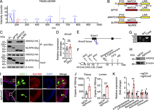 Identification of ANXA2 and generation of ANXA2-deficient mice. (A) Peptides of ANXA2 were identified by mass spectrometry. (B and C) Domain mapping analysis of ANXA2-binding domains of NLRP6 protein. Schematic diagram showing truncation mutants of NLRP6 (B). Different truncation mutants NLRP6-Myc and ANXA2-HA were transfected into HEK293T cells for 48 h. Cell lysates were incubated anti-Myc beads. Proteins precipitated on the beads were analyzed with anti-Myc and anti-HA antibodies. β-Actin was used as a loading control (C). (D) Relative Anxa2 expression levels of intestinal crypts from WT and DKO mice were detected by qRT-PCR. Fold changes were normalized to endogenous 18S (n = 6 mice for each group). (E) Construction diagram of ANXA2 KO mouse with CRISPR-Cas9. (F) Diagram of mice injected with AAV to KO ANXA2 and then infected with S. Typhimurium. (G) DNA electrophoresis for Cas9 knock-in validation. (H) Western blot for ANXA2 KO validation with ANXA2 antibody. β-Actin was used as a loading control. (I) Immunofluorescence staining of intestinal organoids from littermate sgCtr and sgAnxa2 mice. Green: UEA-1, red: EpCAM, and blue: DAPI. Scale bar: 10 μm. (J) Intestinal lumen (left) and tissue-associated (right) bacterial load analysis, quantified by qPCR of 16S rRNA gene copy number in distal ileums of WT and sgAnxa2 mice (n = 6 mice for each group). (K) qPCR detection of ileal luminal commensal bacteria classified by phylum (n = 6 mice for each group). Data in D, J, and K are shown as means ± SEM; significance was determined by unpaired two-tailed Student’s t test (*P < 0.05; ***P < 0.001; ns, not significant). Data in A, C, D, and G–K are representative of at least three independent experiments. Source data are available for this figure: SourceData FS4.