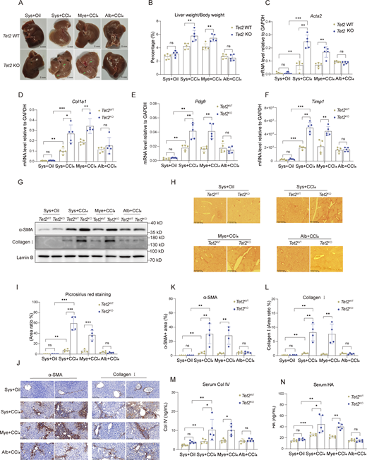 Loss of Tet2 in myeloid cells exacerbates liver fibrosis. (A) Representative pictures of fibrotic liver from three types of Tet2-deficient mice treated with olive oil or CCl4. Sys, systemic Tet2 KO; Mye: myeloid cell–specific Tet2 KO; Alb: hepatocyte-specific Tet2 KO. 7-wk-old Tet2-deficient and Tet2-WT littermates were used to establish liver fibrosis model (n = 5 for each group). Pathological liver fibrosis lesions are indicated by green arrows in the Tet2ΔSys and Tet2ΔMye groups. Scale bar, 5 mm. (B) Statistical analysis of liver/body weight ratios of each group as shown in Fig. 1 A (n = 5 for each group). (C–F) mRNA levels of Acta2 (C), Col1a1 (D), Pdgfr (E), and Timp1 (F) in liver tissues of mice depicted in Fig. 1 A (n = 5 for each group). Gene expression levels were normalized to Gapdh. (G) Protein levels of collagen I and α-SMA in the liver tissues of different groups of mice were quantified by western blotting assay. Protein expression levels were normalized to Lamin B. (H and I) The Picrosirius red staining (scale bar, 125 μm) (H) and statistical analysis (I) of ratio of positive staining area (n = 4 for each group). Statistical analysis was performed using Image-Pro Plus 6.0. (J–L) IHC staining (scale bar, 100 μm) (J) and statistical analysis of α-SMA (K) and collagen I (L) of ratio of positive staining area of liver tissues to analyze collagen deposition and expression in different groups of mice. Statistical analysis was performed using Image-Pro Plus 6.0 (n = 4 for each group). (M and N) Serum levels of Col IV (M) and HA (N) in different types of Tet2-deficient mice with liver fibrosis (n = 5 for each group). Data are representative of at least two independent experiments with similar results (A–N). All data are shown as mean ± SD and were analyzed by two-way ANOVA with Tukey’s multiple comparison test (B–F, I, and K–N). ***P < 0.001; **P < 0.01; *P < 0.05; P > 0.05 not significant (ns). Timp1, TIMP metallopeptidase inhibitor 1; Pdgfr, platelet-derived growth factor receptor. Source data are available for this figure: SourceData F1.