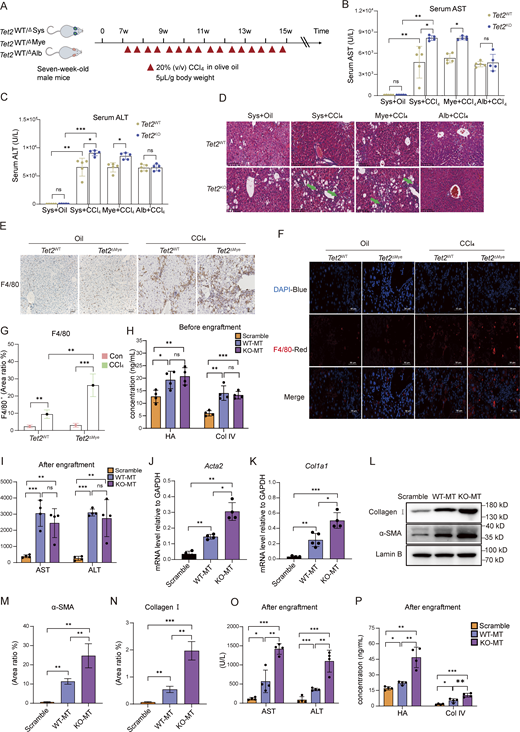 Effect of Tet2ΔMyeon hepatic fibrosis progression. (A) Treatment schedule for the construction of a CCl4-induced mouse model in systemic Tet2 KO (Tet2ΔSys) mice, hepatocyte-specific Tet2 KO (Tet2ΔAlb) mice, and myeloid cell–specific Tet2 KO (Tet2ΔMye) mice. 7-wk-old male littermates (Tet2 WT or KO) were used to construct a liver fibrosis model. (B and C) Serum levels of AST (B) and ALT (C) in different types of Tet2-deficient mice with liver fibrosis (n = 5 for each group). (D) H&E staining of livers in different types of Tet2-deficient liver fibrosis mouse models. Green arrows indicate infiltrated immune cells in liver tissues. (E) IHC staining of F4/80 in liver tissues of Tet2ΔMye mice treated with oil or CCl4 (n = 4 for each group). Scale bar, 100 μm. (F and G) IF staining (F) and statistical analysis (G) of F4/80 in liver tissues of Tet2ΔMye mice treated with oil or CCl4 (n = 4 for each group). Blue: DAPI; red: anti-F4/80. (H and I) Serum levels of AST and ALT measured by serum analyzer in CD45.1 mice before (H) and after (I) transplantation of CD11b+Tet2+/+ or CD11b+Tet2−/− myeloid cells (n = 4 for each group). (J and K) mRNA levels of Acta2 (J) and Col1a1 (K) in livers of scramble, WT-MT, and KO-MT mice (n = 4 for each group). (L) Expression levels of α-SMA and collagen I measured by western blot. (M and N) Statistical analysis of α-SMA (M) and collagen I (N)-positive area ratio for IHC staining in liver of scramble, WT-MT, and KO-MT mice (n = 4 for each group). (O) Serum levels of AST and ALT measured by serum analyzer in scramble, WT-MT, and KO-MT mice (n = 4 for each group). (P) Serum levels of HA and Col IV measured by ELISA in scramble, WT-MT, and KO-MT mice (n = 4 for each group). Data are representative of at least two independent experiments with similar results (B–O). All data are shown as mean ± SD and were analyzed by two-way ANOVA with Tukey’s multiple comparison test (B, C, and G) or one-way ANOVA with Tukey’s multiple comparison test (H–K and M–P). ***P < 0.001; **P < 0.01; *P < 0.05; P > 0.05 not significant (ns). Source data are available for this figure: SourceData FS1.